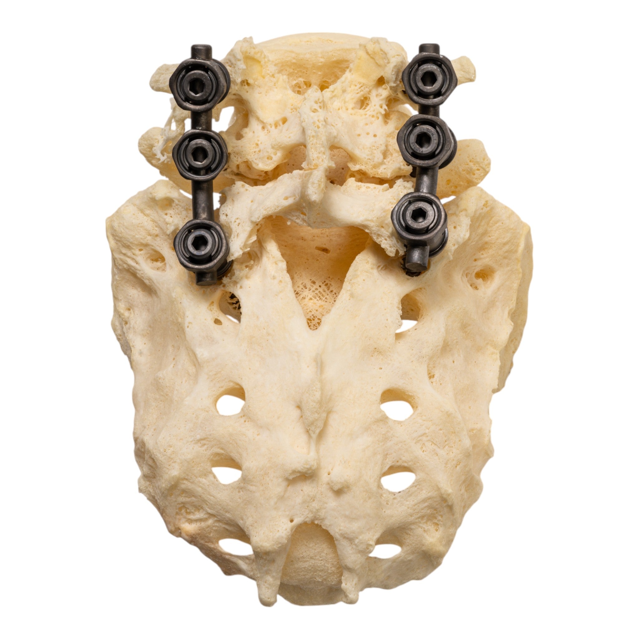 Premium Disarticulated Human Skeleton Model for Medical Study - Anatomical Pathology Teaching Aid for Students & Professionals - Perfect for Classroom, Lab & Medical Training
