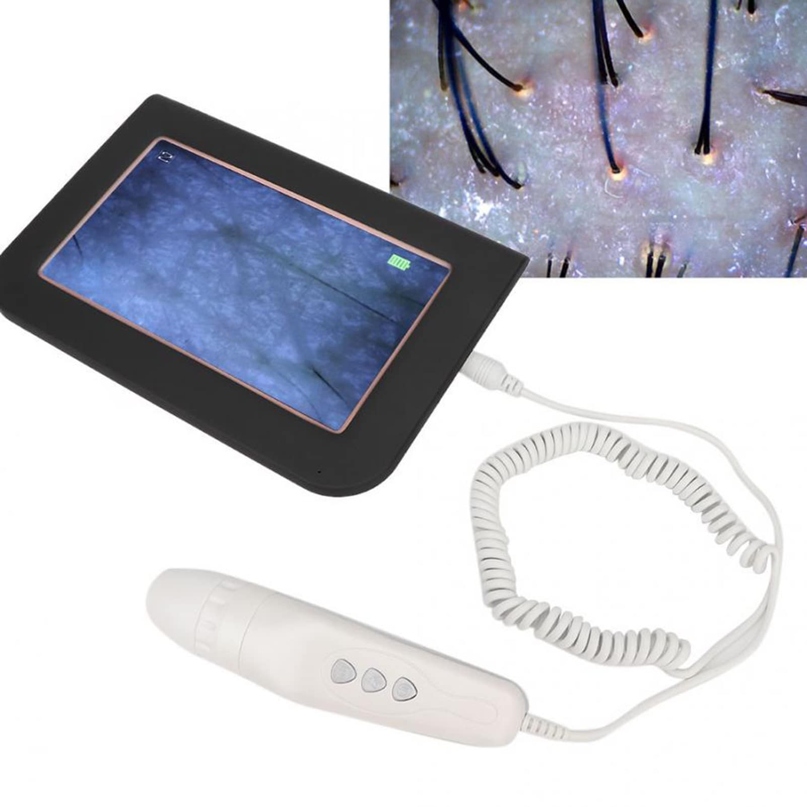 Professional Skin & Hair Analyzer - 50X/200X Magnification Facial Skin Health Detector, Moisture & Pigment Tester, Home & Salon Use - Perfect for Skin Diagnosis, Hair Analysis & Beauty Care