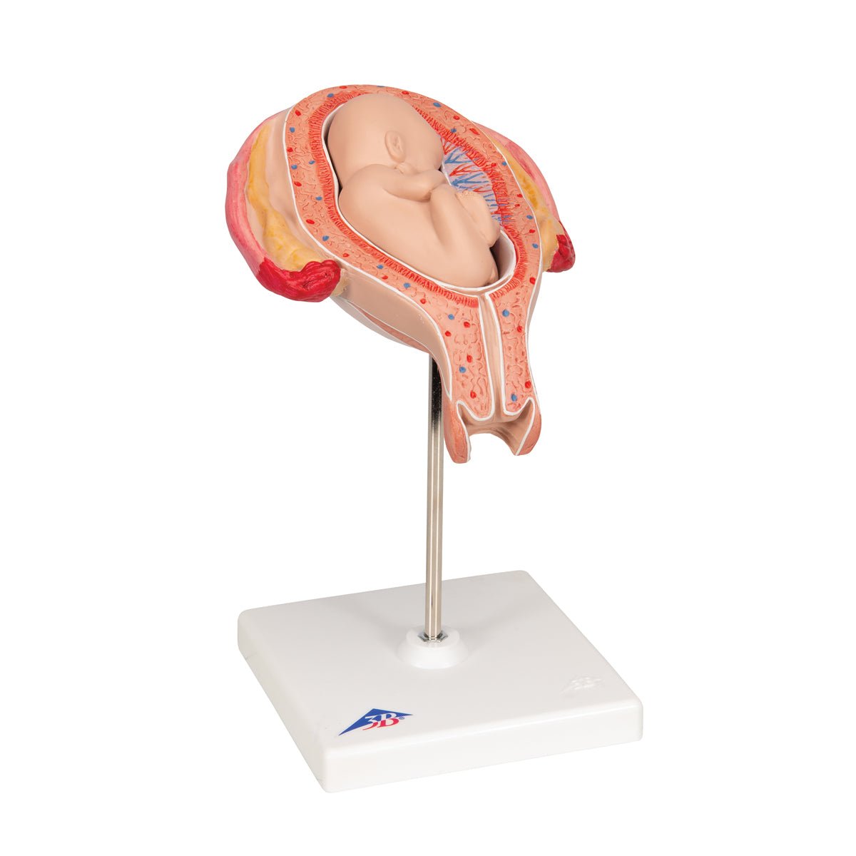 5-Month Fetus in Breech Position - Realistic Pregnancy Model for Medical Education & Training | Perfect for Obstetrics Students, Doctors & Midwives