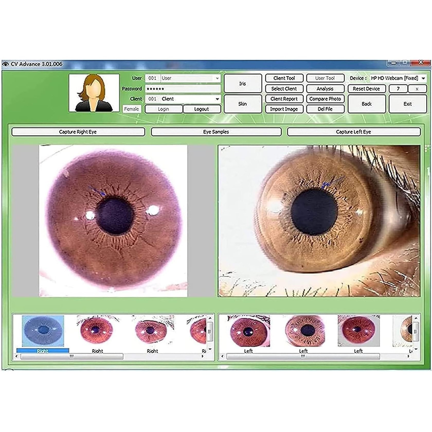 Automatic Iris Detector Camera - Professional Iridology Analysis Tool with Adjustable Focus for Eye Health Diagnosis | Perfect for Naturopaths, Holistic Practitioners & Eye Care Specialists