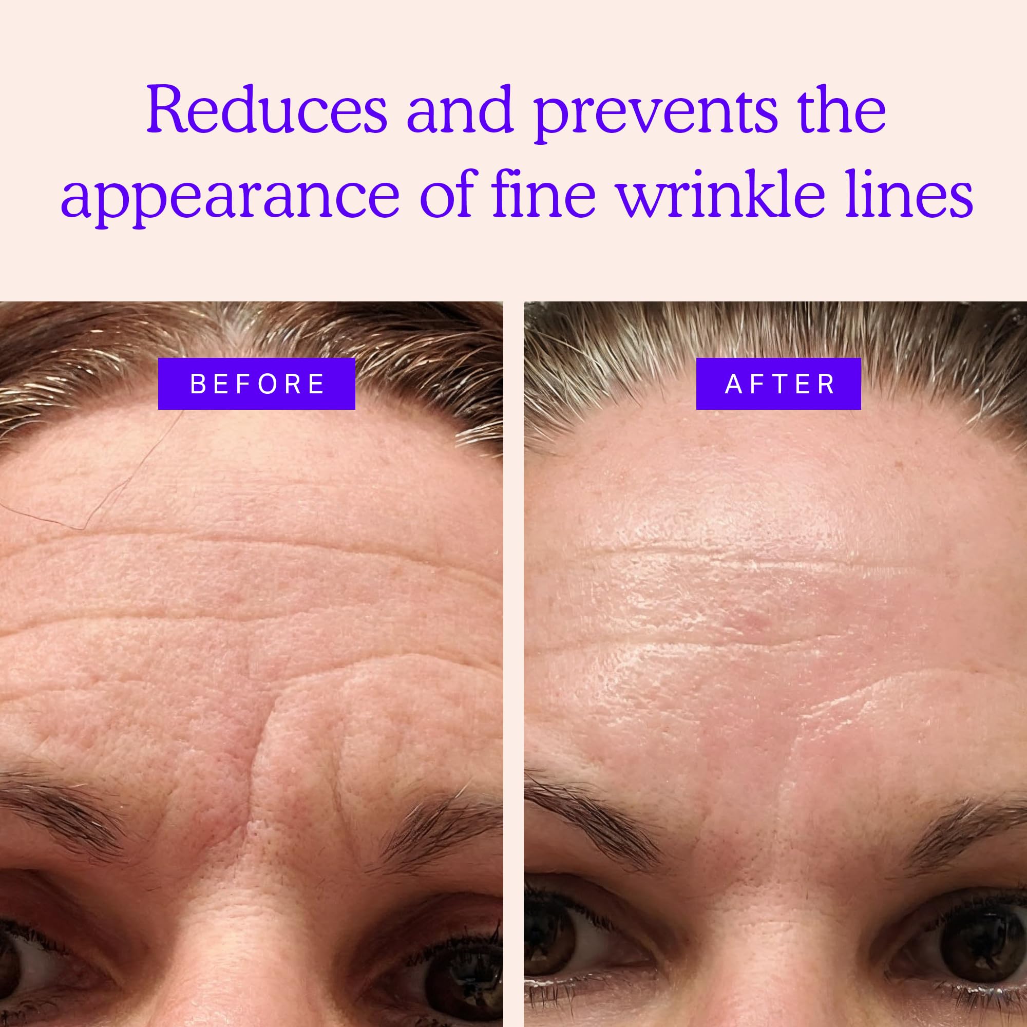 BLUMBODY Anti-Wrinkle Face Patches Set - Mini, Chest & Neck Wrinkle Pads for Smooth Skin | Reduce Fine Lines & Wrinkles | Perfect for Nighttime Skincare & Special Occasion Prep