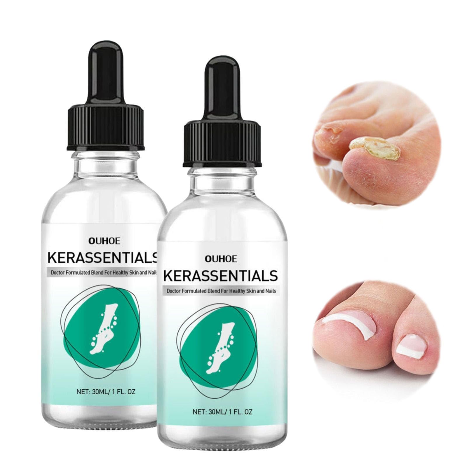 Extra Strength Toenail Fungus Treatment - Fast-Acting Nail Repair Solution for Damaged & Discolored Nails - Fungal Nail Renewal Liquid (2 Pack) - Ideal for Athletes, Swimmers & Pedicure Lovers