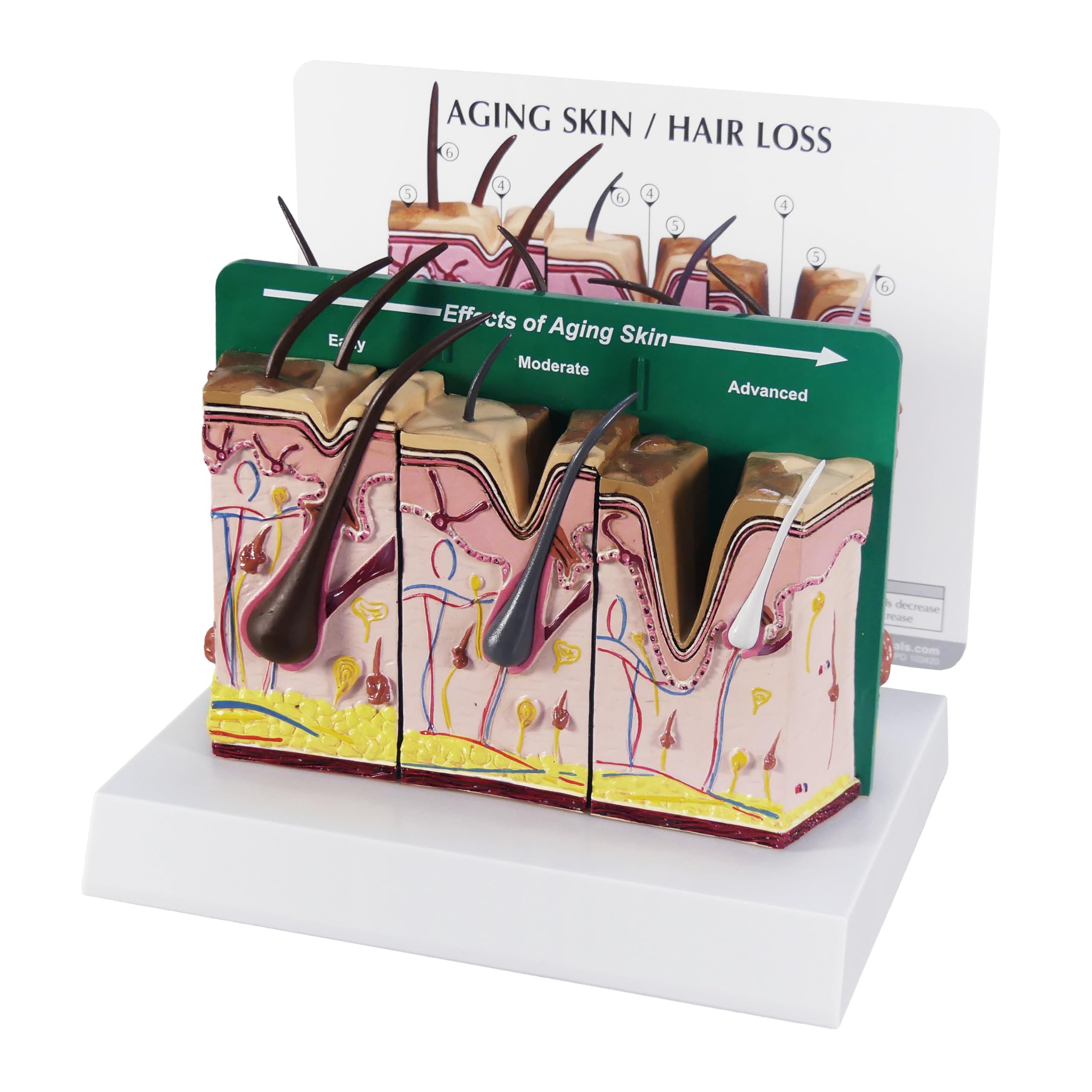 GPI Anatomicals - Aging Skin and Hair Loss Model, Human Anatomy Replica for Medical Education | Shows Aging vs Normal Skin | Ideal for Doctor Offices, Medical Schools & Physiology Learning | Perfect for Dermatology Training & Patient Education
