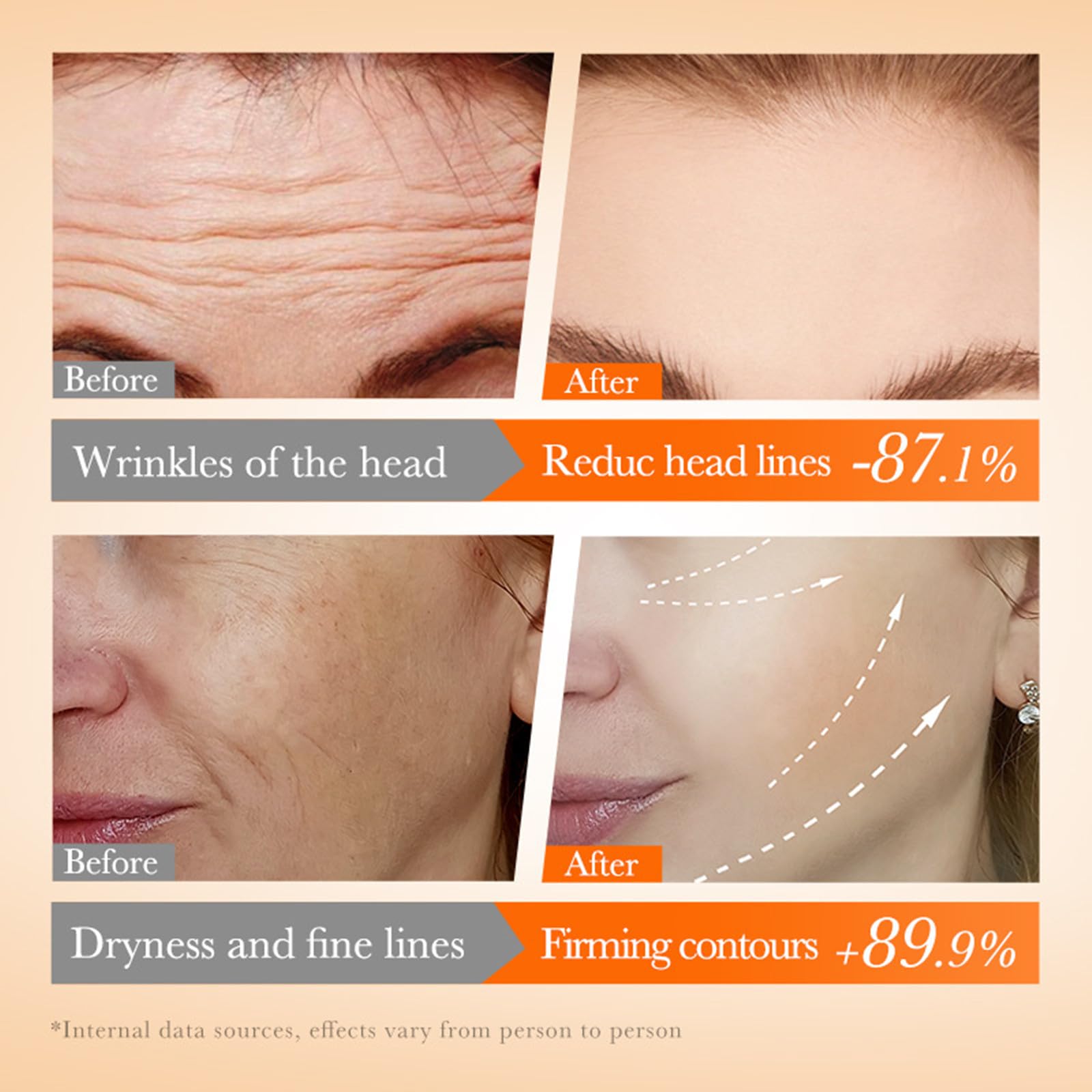 **Vitamin C Face Serum & Collagen Face Mask Set - Hydrating & Soothing Skincare Gift Box with 4 Pcs Essence Masks for Forehead & Cheeks | Perfect for Daily Hydration, Spa Nights & Travel Skincare**