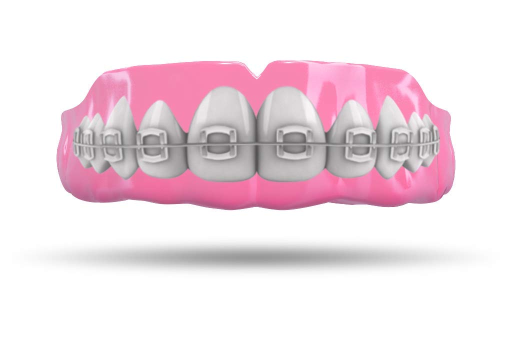 Professional Custom-Fit Impact Mouthguard for Boxing, MMA & Muay Thai - Youth & Adult Sports Protection - Perfect for Training, Competition & Braces Wearers