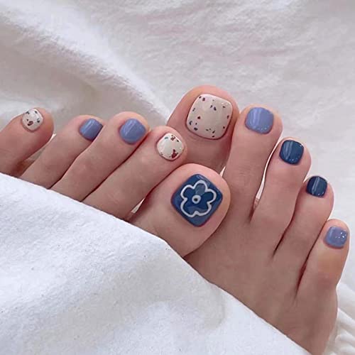 Blue Toenails