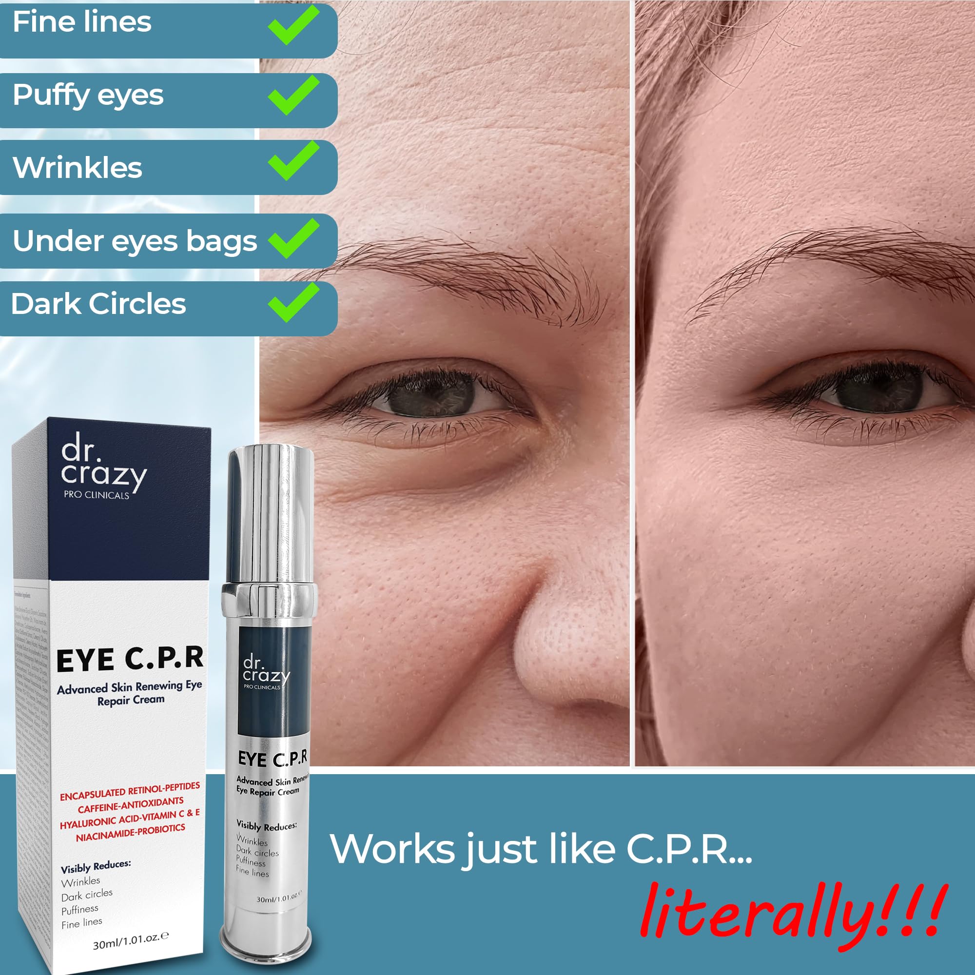 Dr Crazy CPR Repair Eye Cream - Anti-Puffiness & Dark Circle Treatment for Women | Under Eye Bags Cream | 30ml | Perfect for Night Routine & Travel Skincare
