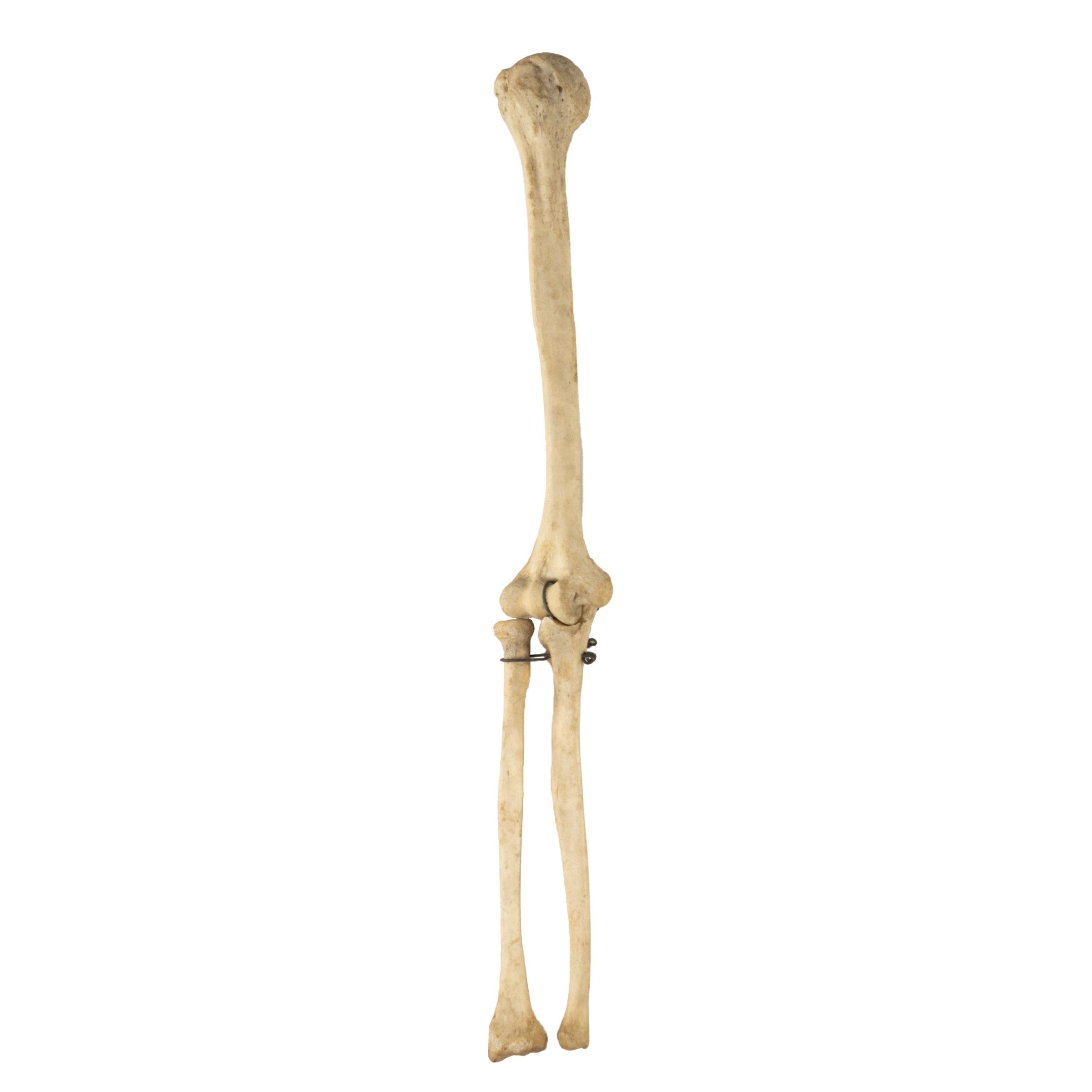 Authentic Human Humerus, Radius & Ulna Bones - Medical Study, Anatomy Education & Science Classroom Specimen