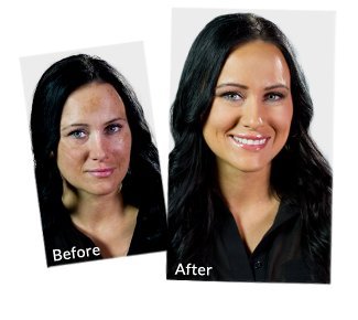 **Dinair Airbrush Makeup Foundation - Bronze 0.25 oz | Camouflage Neutralizer for Scars, Acne, Tattoos, Vitiligo & Dark Circles | Flawless Coverage for Sun Spots & Under Eyes | Perfect for Bridal, Photography & Everyday Wear**