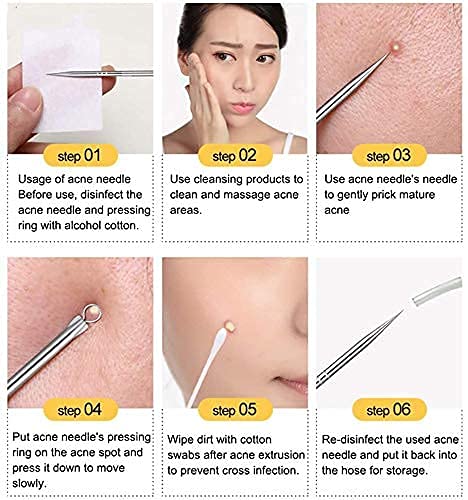 Professional Blackhead & Pimple Remover Kit - Stainless Steel Comedone Extractor & Ear Wax Cleaner Set with Storage Box (2-Piece) - Perfect for Acne Treatment & Ear Hygiene at Home