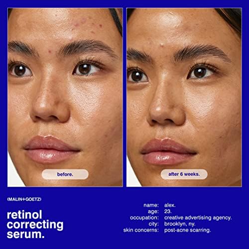 Malin + Goetz Retinol Correcting Serum 1oz (30ml) - Sensitive Skin Face Serum with Brightening & Anti-Aging Benefits | Vegan & Cruelty-Free Retinol Cream for Night Routine & Daily Skincare Regimen