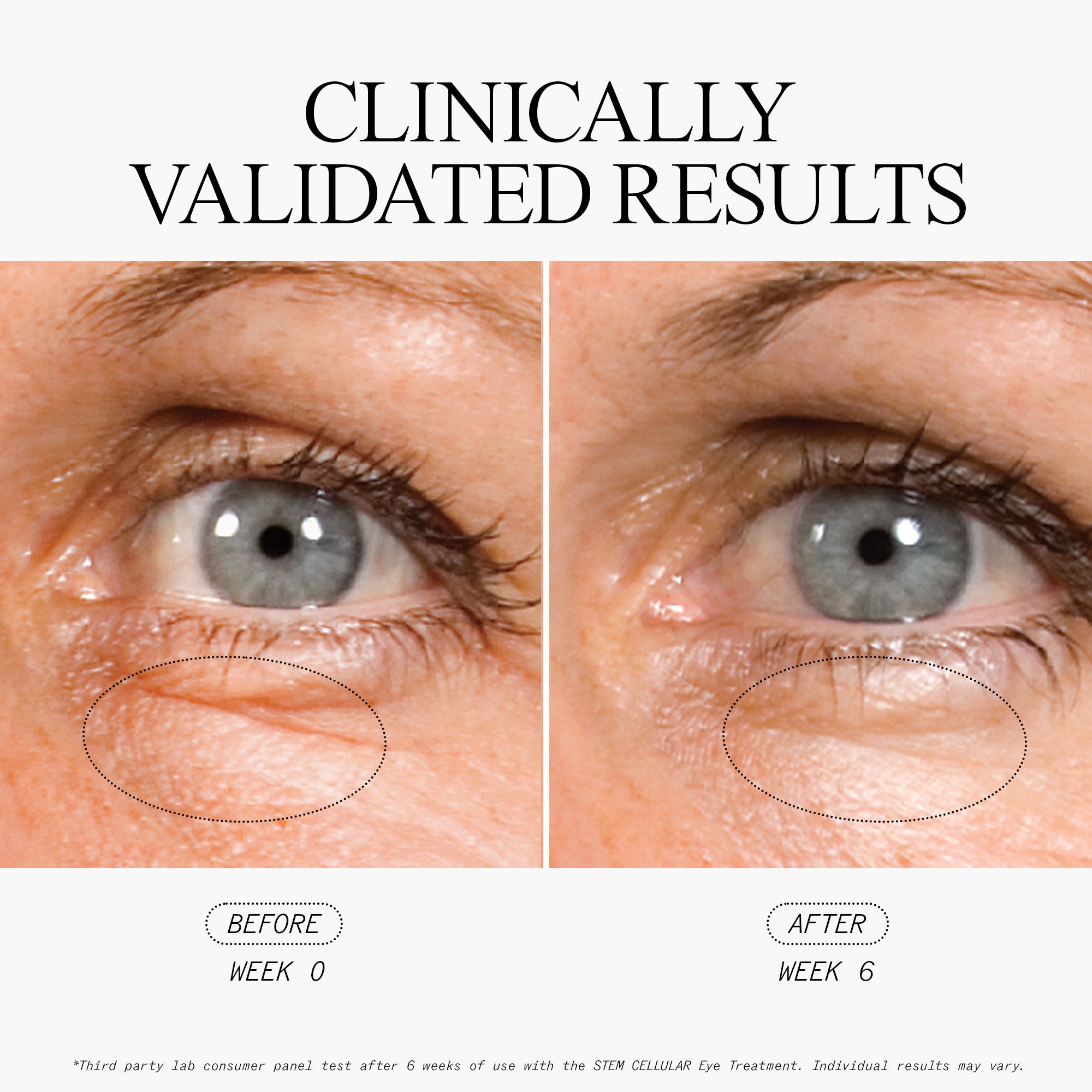 Best Anti Wrinkle Eye Cream for Dark Circles & Puffiness - Reduce Fine Lines & Wrinkles - Hydrating Under Eye Treatment for Men & Women - Perfect for Nighttime Skincare Routine & Travel