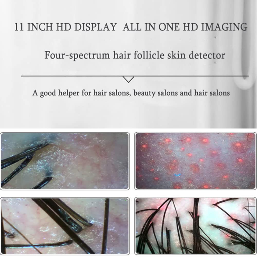Digital Skin & Hair Scalp Analyzer - 11