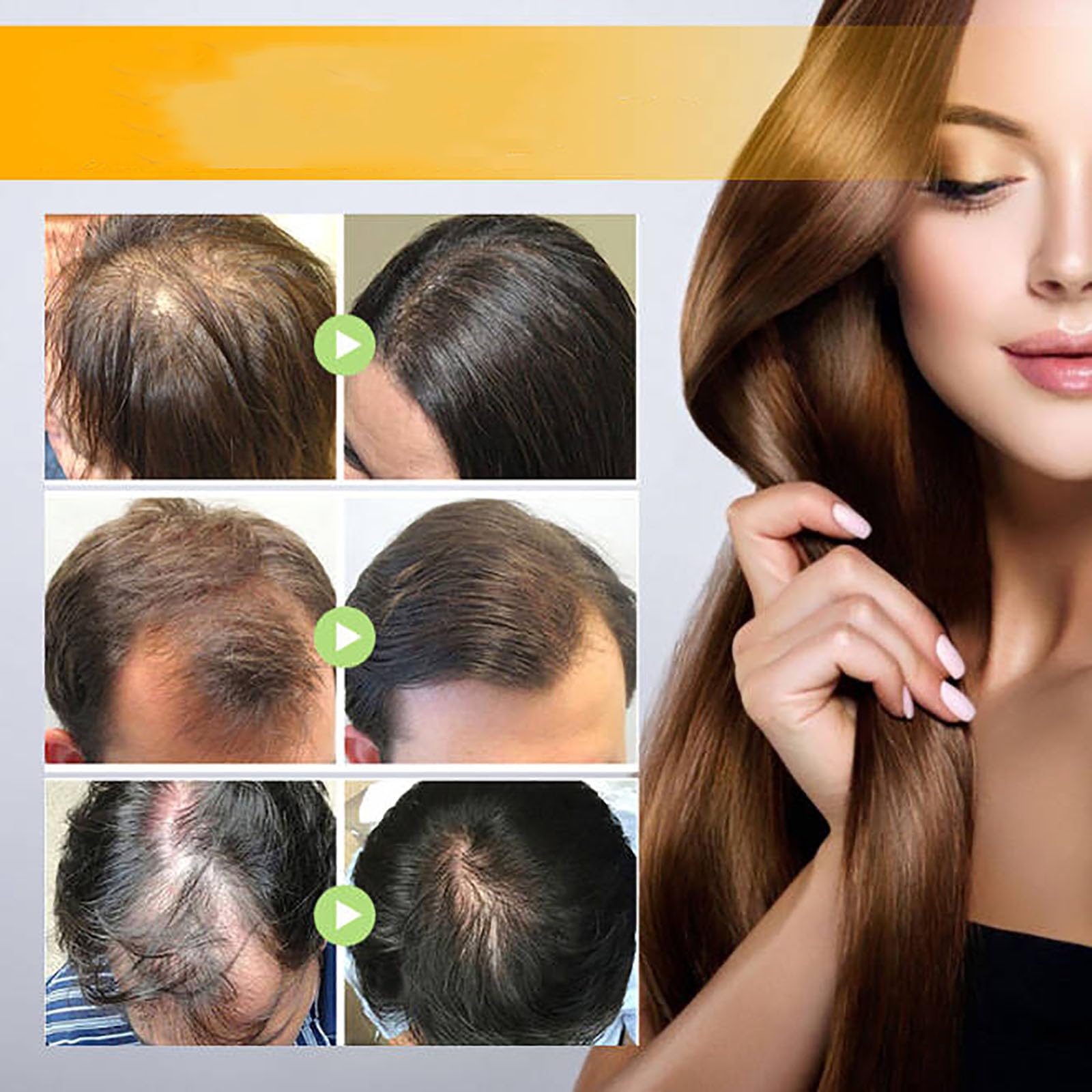 Onest Cosmetics Anti-Greying Hair Growth Oil with Amla & Sunflower - Rosemary Hair Serum for Hair Loss Prevention & Nourishment - Promotes Healthy Hair Growth for Men & Women (Use for Daily Scalp Massage, Hair Care Routine, and Thinning Hair Treatment)