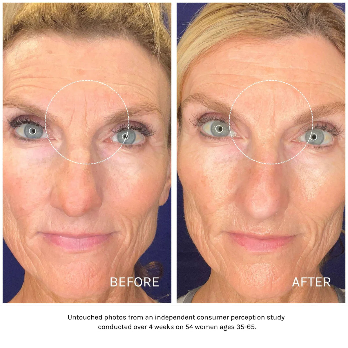 Best Essential Peptide Serum for Anti-Aging & Skin Repair - Hydrating Facial Treatment for Wrinkles & Fine Lines | Day & Night Use