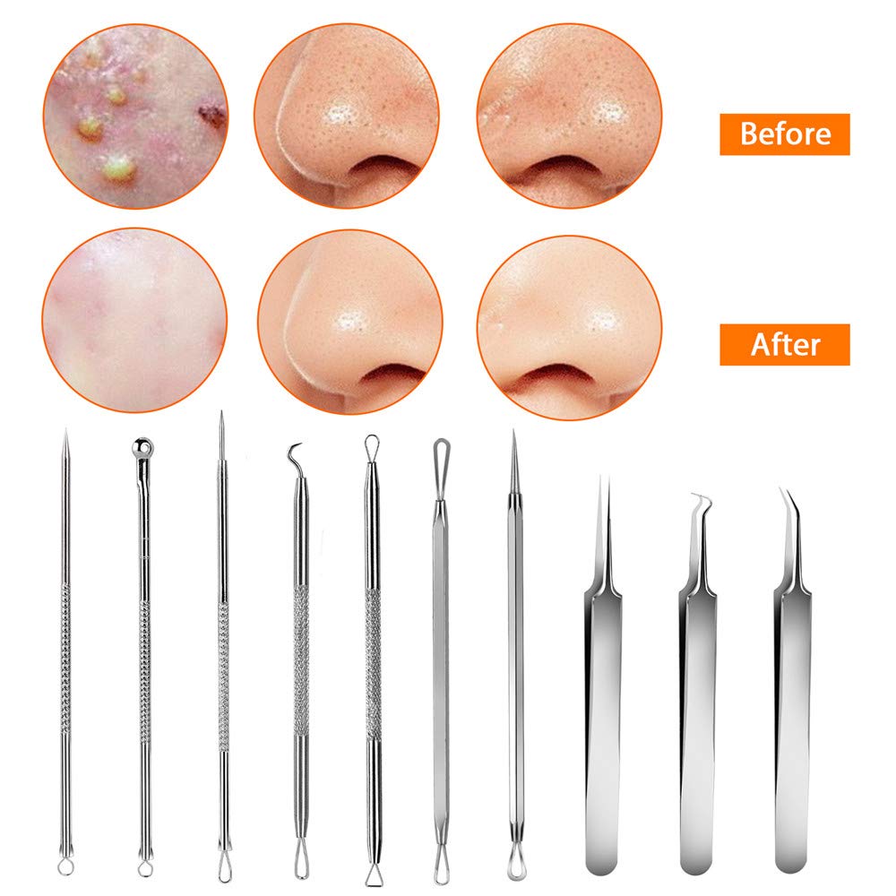 Best Blackhead Remover Vacuum Tool - Pore Cleaner for Deep Cleansing | Perfect for Acne Prone Skin & Facial Care Routine
