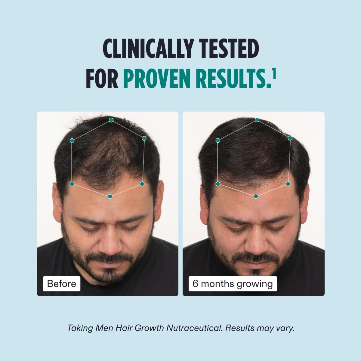 Nutrafol Men's Hair Growth Supplement & Serum for Thicker, Stronger Hair - 3 Month Supply (1.7 Fl Oz) - Reduce Hair Loss & Promote Healthy Growth for Daily Hair Care Routine