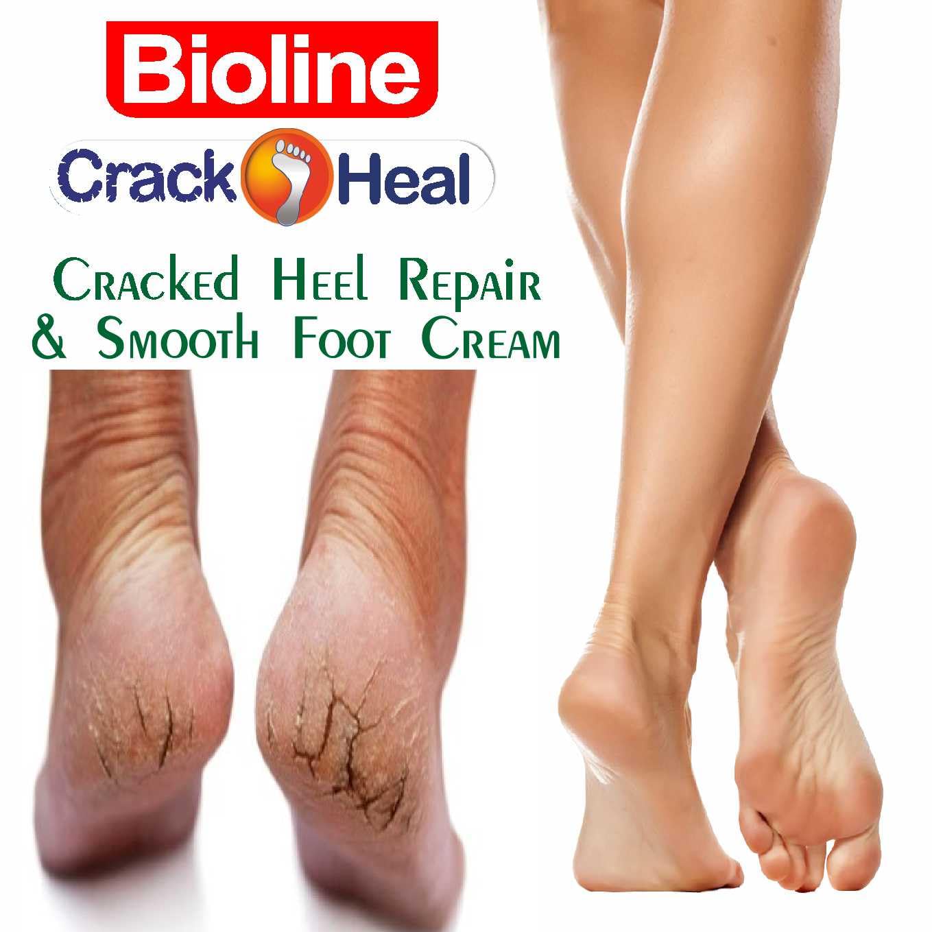 BIOLINE Crack Heal Foot Cream for Dry Skin & Cracked Heels - Moisturizing Treatment for Rough Feet - 25g Each (Pack of 3) - Perfect for Daily Foot Care, Cracked Heel Repair & Softening Dry Skin at Home or Travel