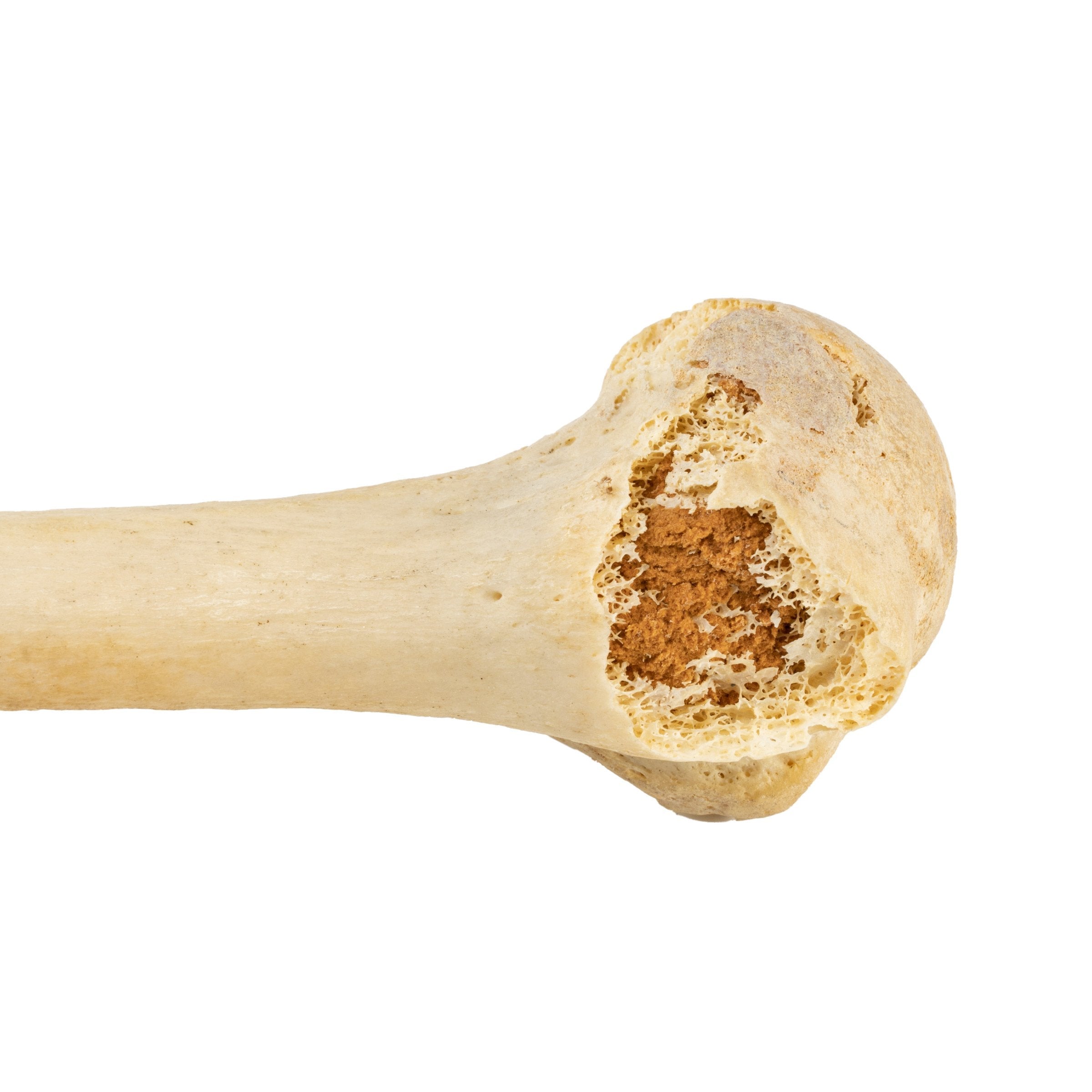 Authentic Human Humerus, Radius & Ulna Bones - Medical Study, Anatomy Education & Science Classroom Demonstration