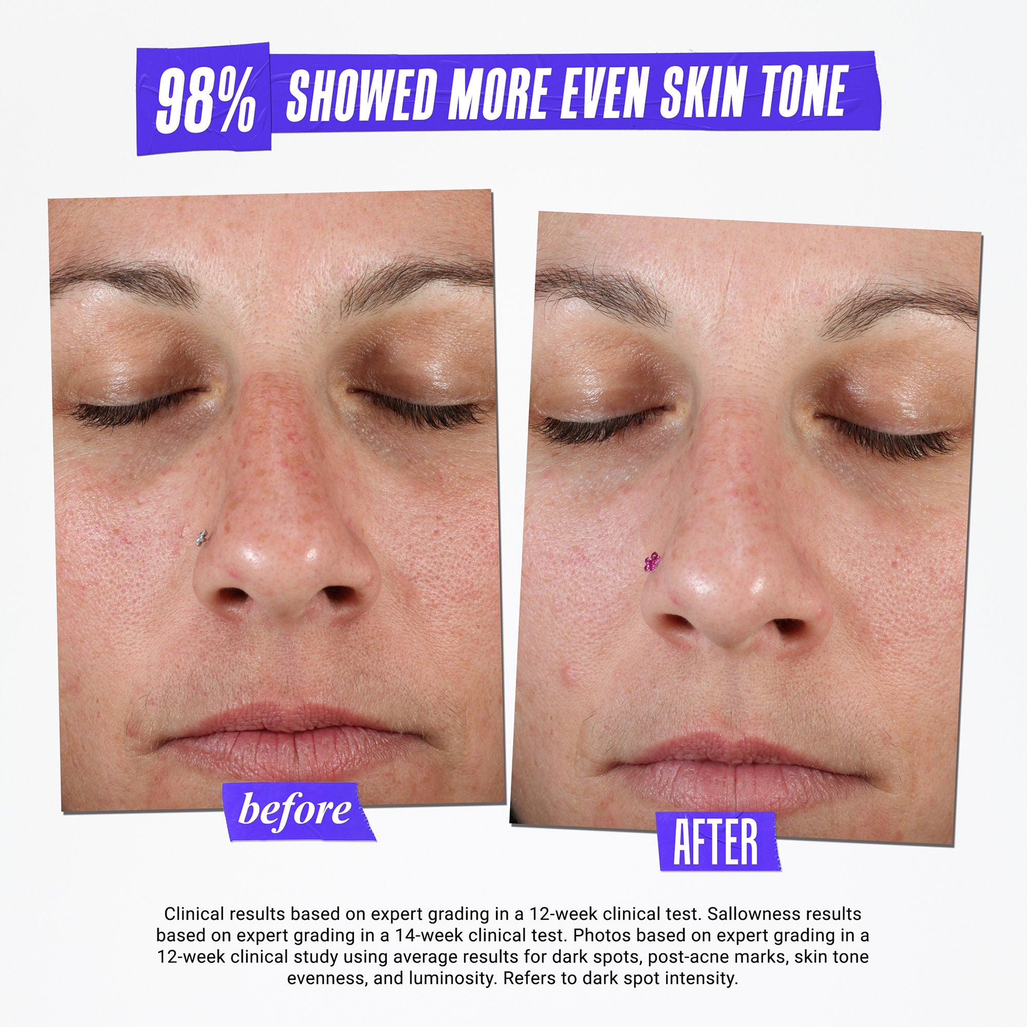 Kiehl's Clearly Corrective Dark Spot Solution - Brightening Serum for Hyperpigmentation & Uneven Skin Tone | Perfect for Daily Skincare Routine & Nighttime Use
