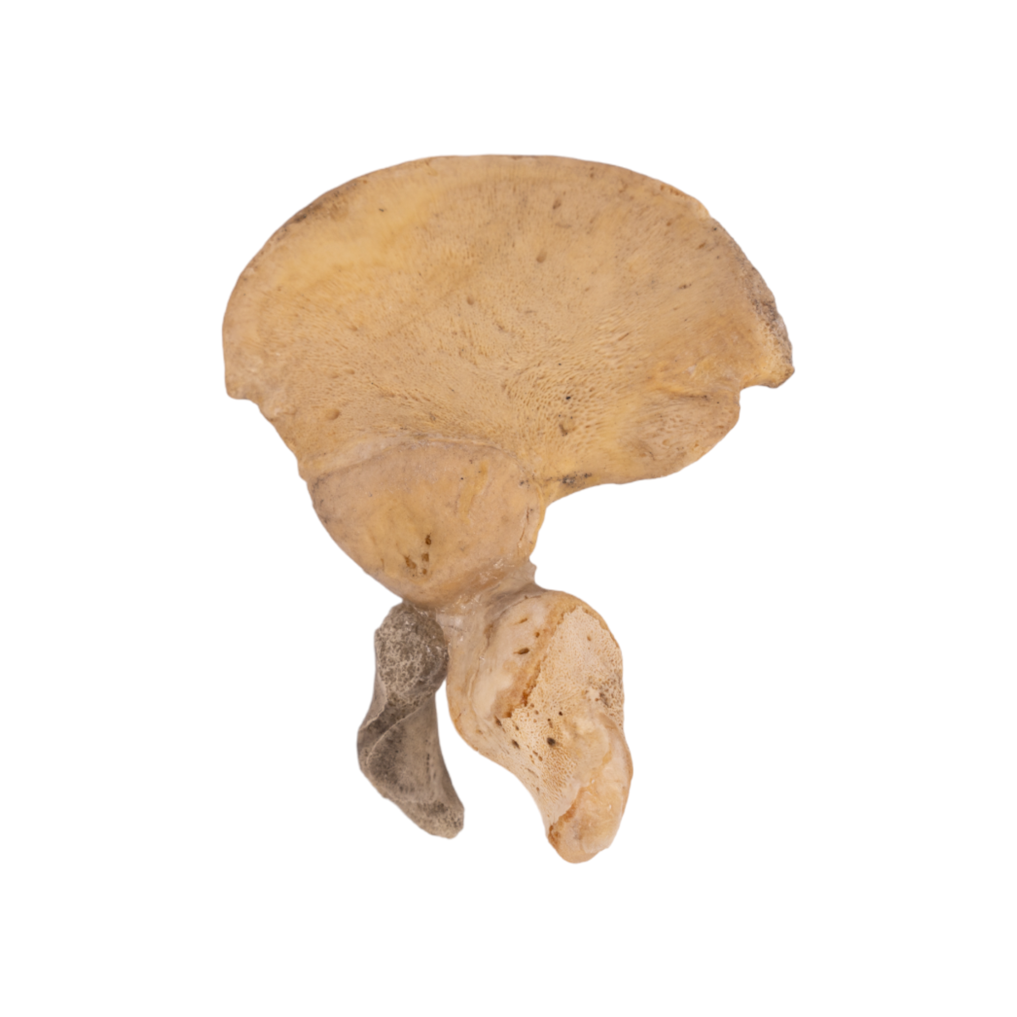 Premium Human Fetal Ilium for Medical Research - High-Quality Anatomical Specimen for Pathology Studies, Medical Education & Scientific Research