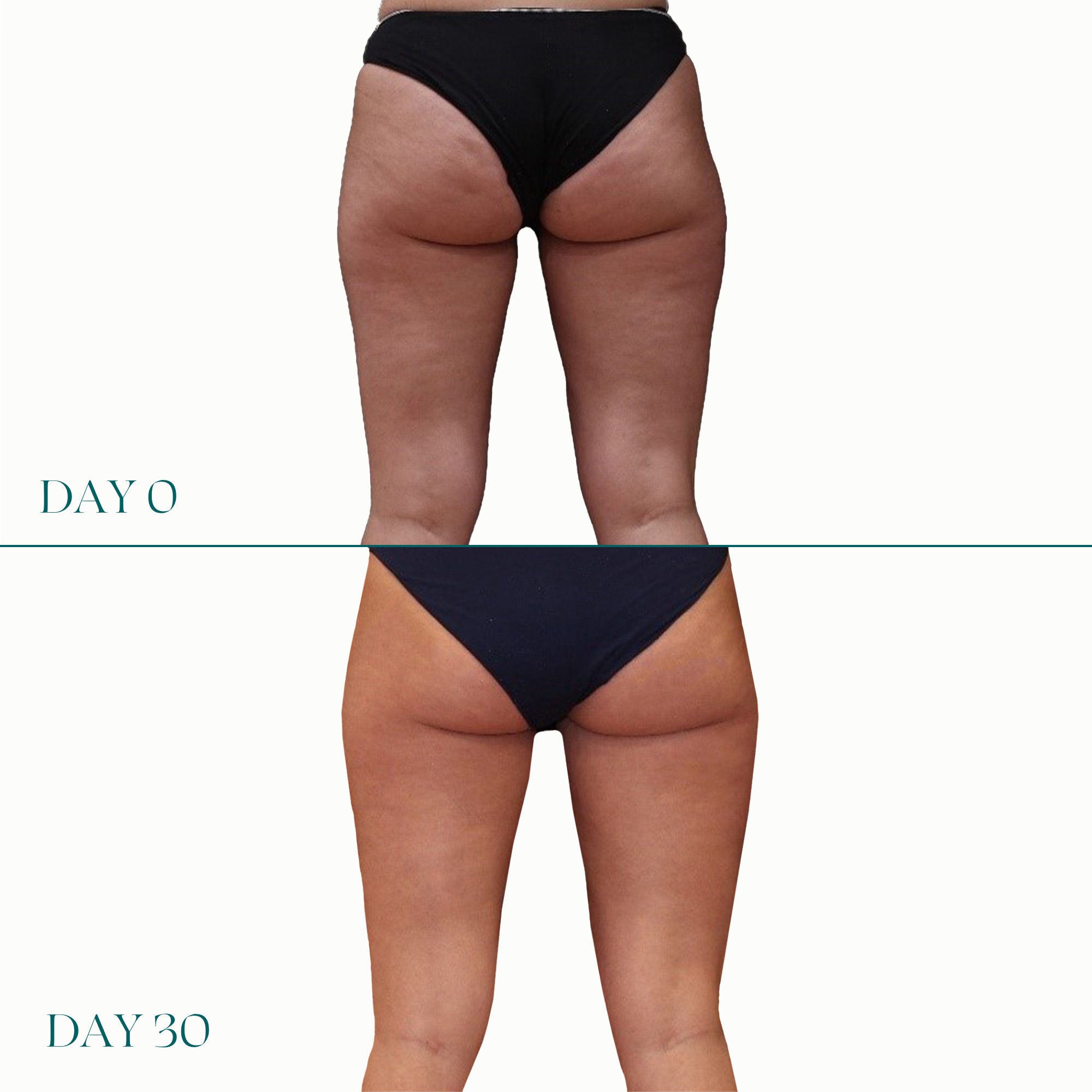 Air Lite Daily Lift For Legs - Lightweight Leg Support for All-Day Comfort - Perfect for Work, Travel & Active Lifestyles