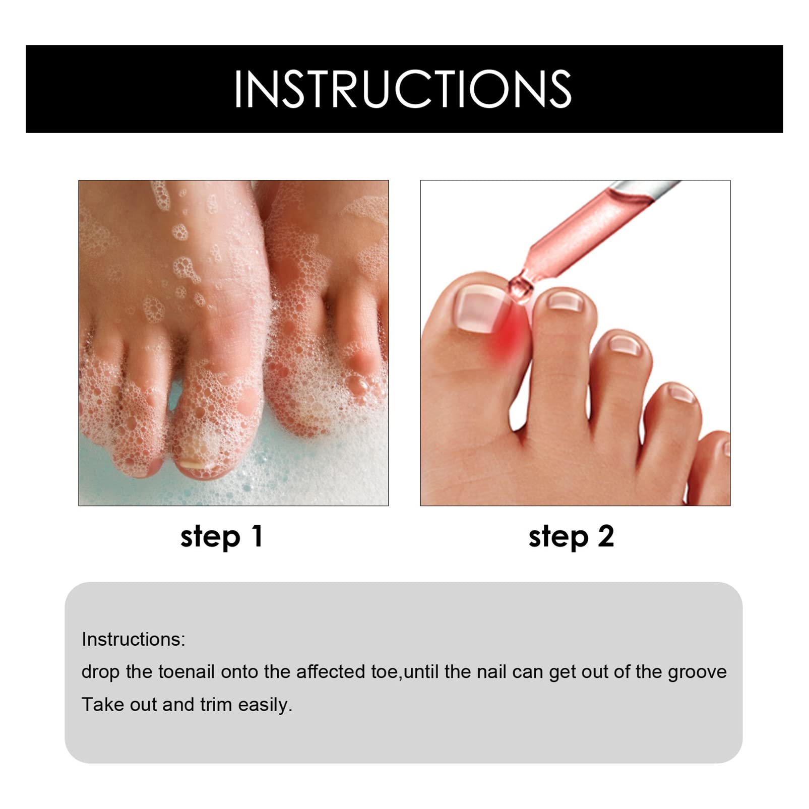 Best Ingrown Toenail Treatment Drops - Fast Relief for Painful Ingrown & Fungal Nails - Cuticle Care & Nail Softening Oil - Perfect for Pedicures, Athletes & Daily Foot Care