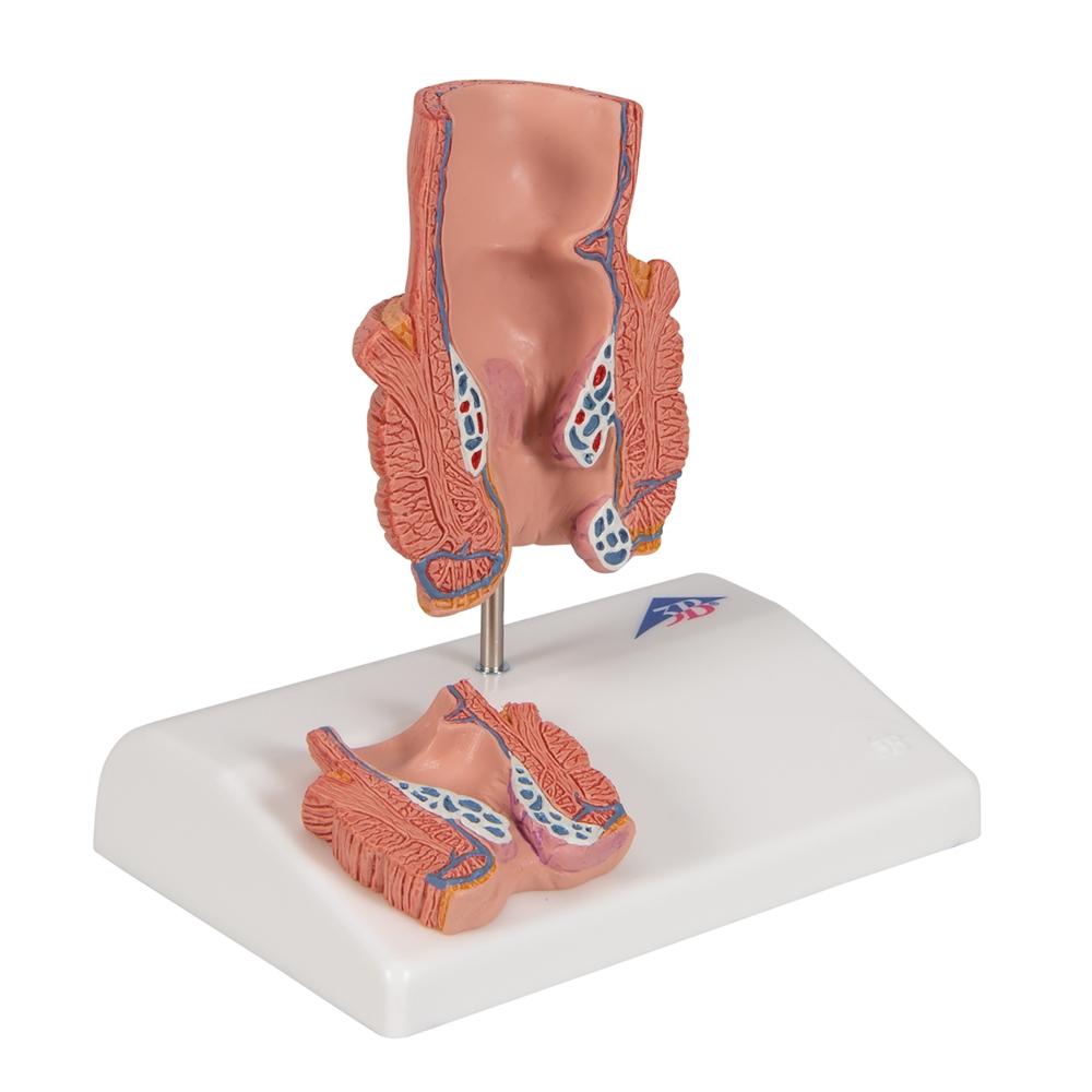 Premium Hemorrhoid Anatomy Model for Medical Training & Patient Education – Ideal for Doctors, Nurses & Healthcare Professionals