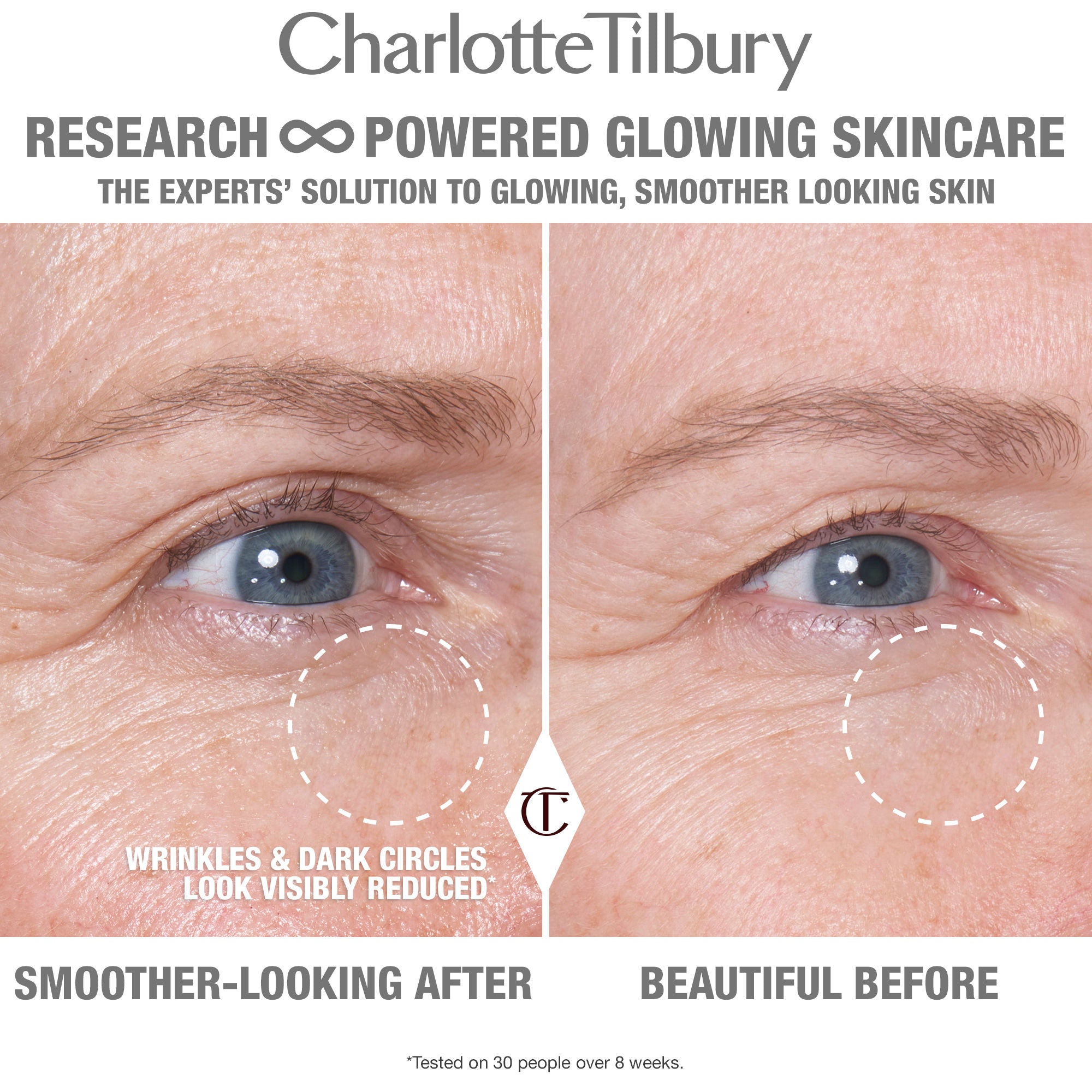 Best Cryo Recovery Eye Serum for Dark Circles & Puffiness - Anti-Aging Under Eye Treatment for Women & Men - Perfect for Morning & Night Skincare Routine