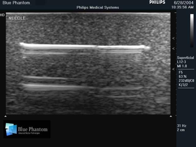 Foreign Body Identification Ultrasound Training Model - High-Quality Medical Simulation Tool for Emergency & Trauma Practice - Perfect for Medical Students, Nurses & First Responders