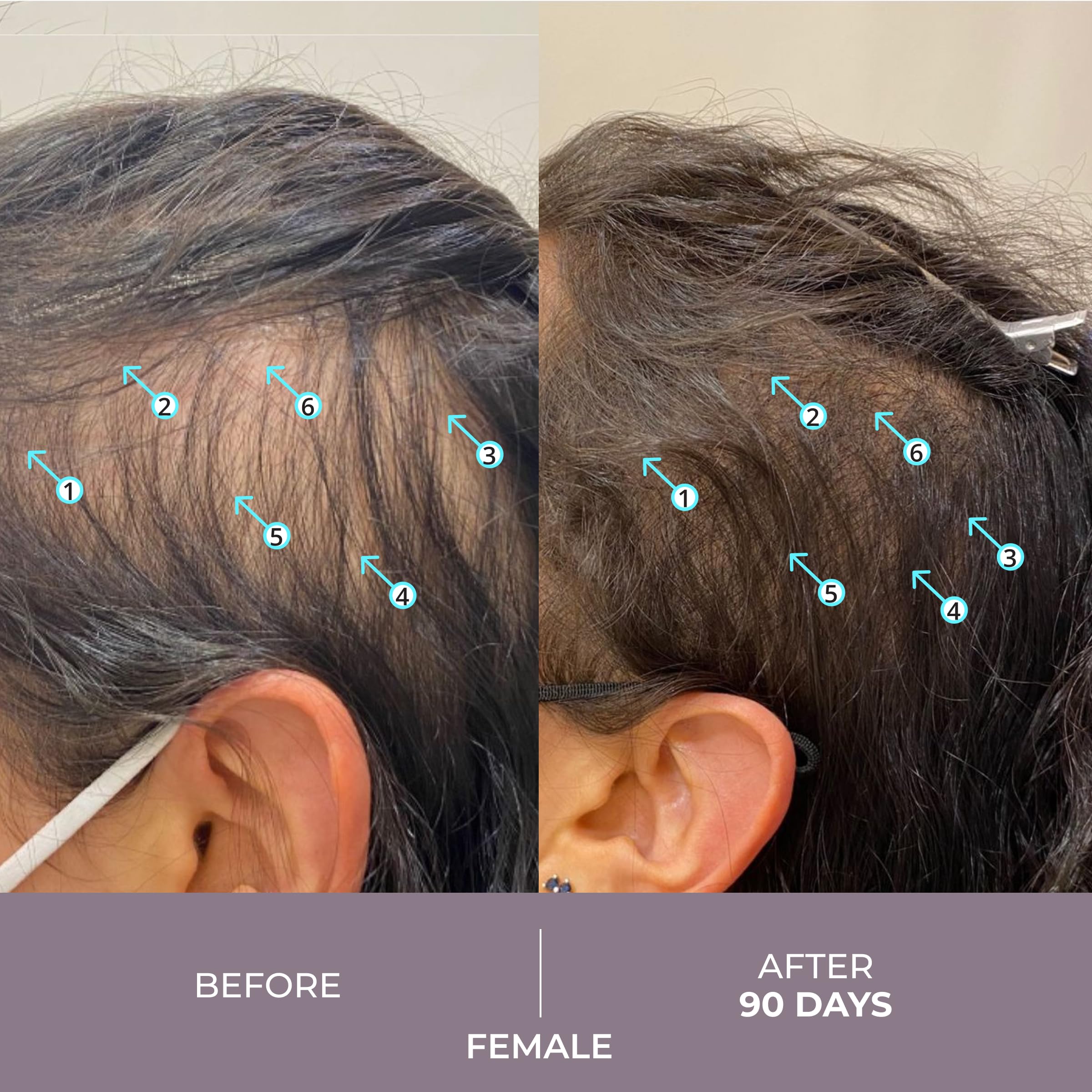 DS Laboratories Spectral.CSF Biotin Hair Serum for Women - Hair Regrowth & Thickening Treatment for Thinning Hair | Strengthens & Nourishes for Fuller, Healthier Locks | Perfect for Daily Use & Styling Prep