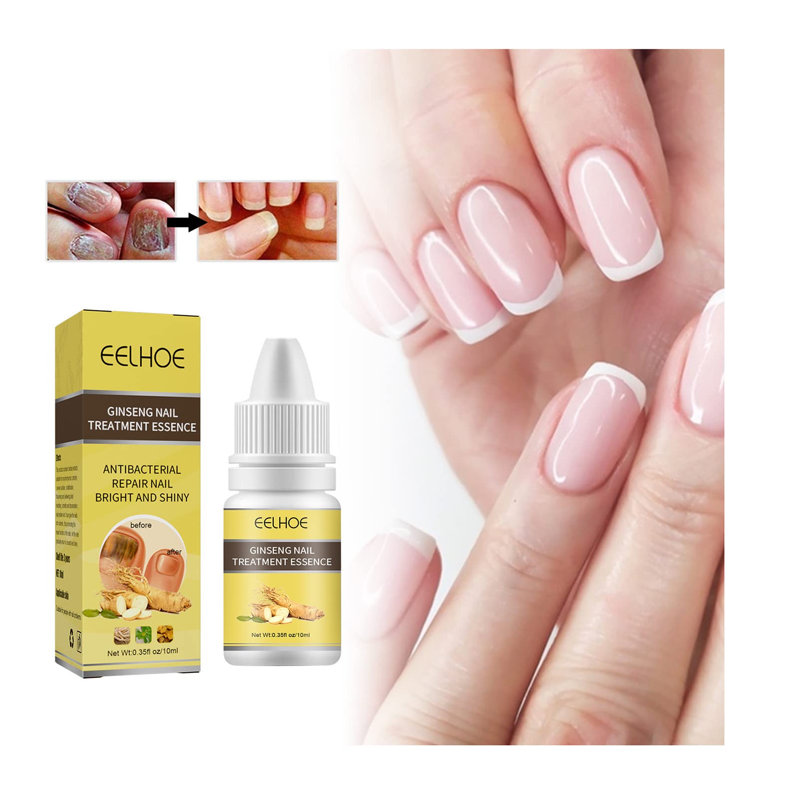 10ml Ginseng Nail Treatment - Herbal Hand & Foot Whitening Cream for Cracked, Rough, Brittle Nails - Natural Nail Care Solution for Toe & Finger Nails - Perfect for Pedicures, Manicures & At-Home Nail Care Routines