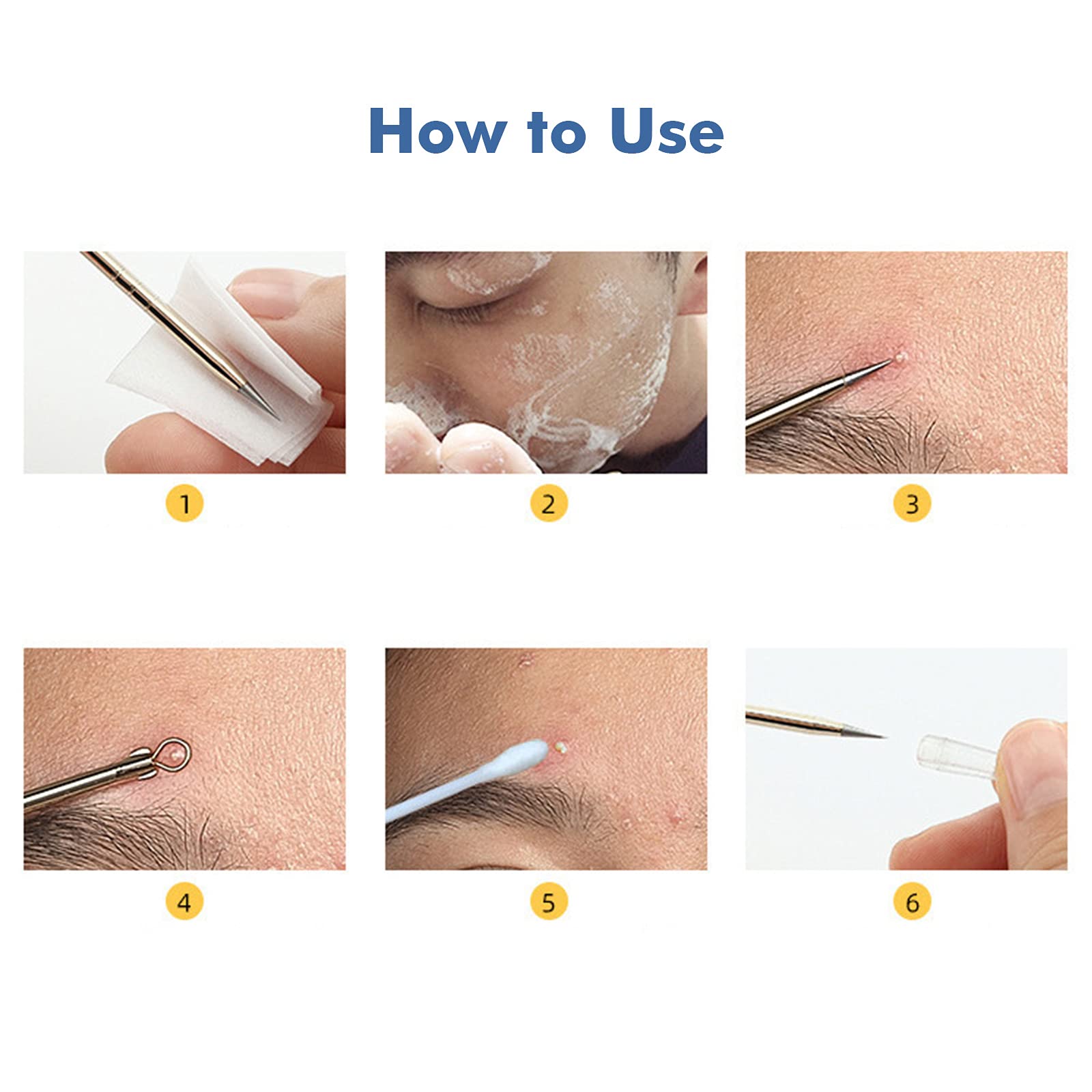 Professional Stainless Steel Blackhead Remover & Comedone Extractor Kit - Acne Pimple Blemish Removal Tools Set for Facial Skin Care & Beauty (2-Piece) - Perfect for Home Spa Treatments & DIY Skincare Routines - Layfoo