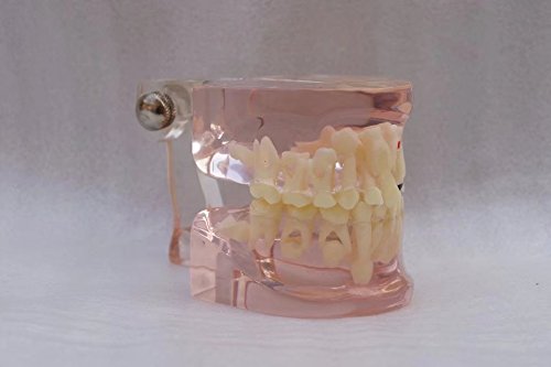 Dental Teaching Demonstration Model - Mixed Age Pathology Implant with Caries & Primary Teeth Extraction - Clear Restoration Training Model for Dental Students & Professionals - Perfect for Classroom, Clinic & Dental Education
