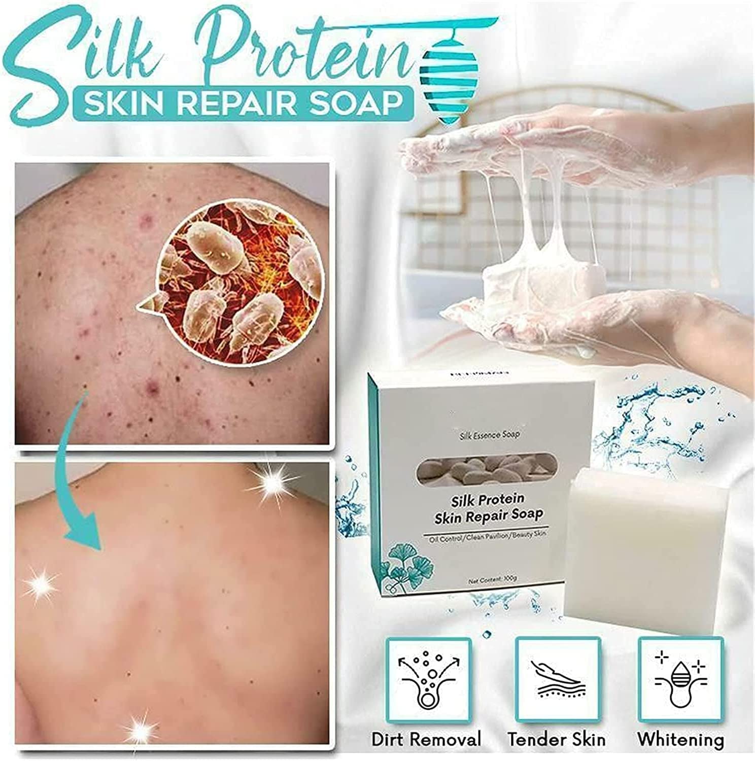 Skinferm Silk Protein Whitening & Repair Soap with Goat Milk - Anti-Acne, Anti-Cellulite, Collagen Enriched (3-Pack) for Clear, Glowing Skin - Perfect for Daily Face & Body Care, Acne Treatment & Skin Brightening