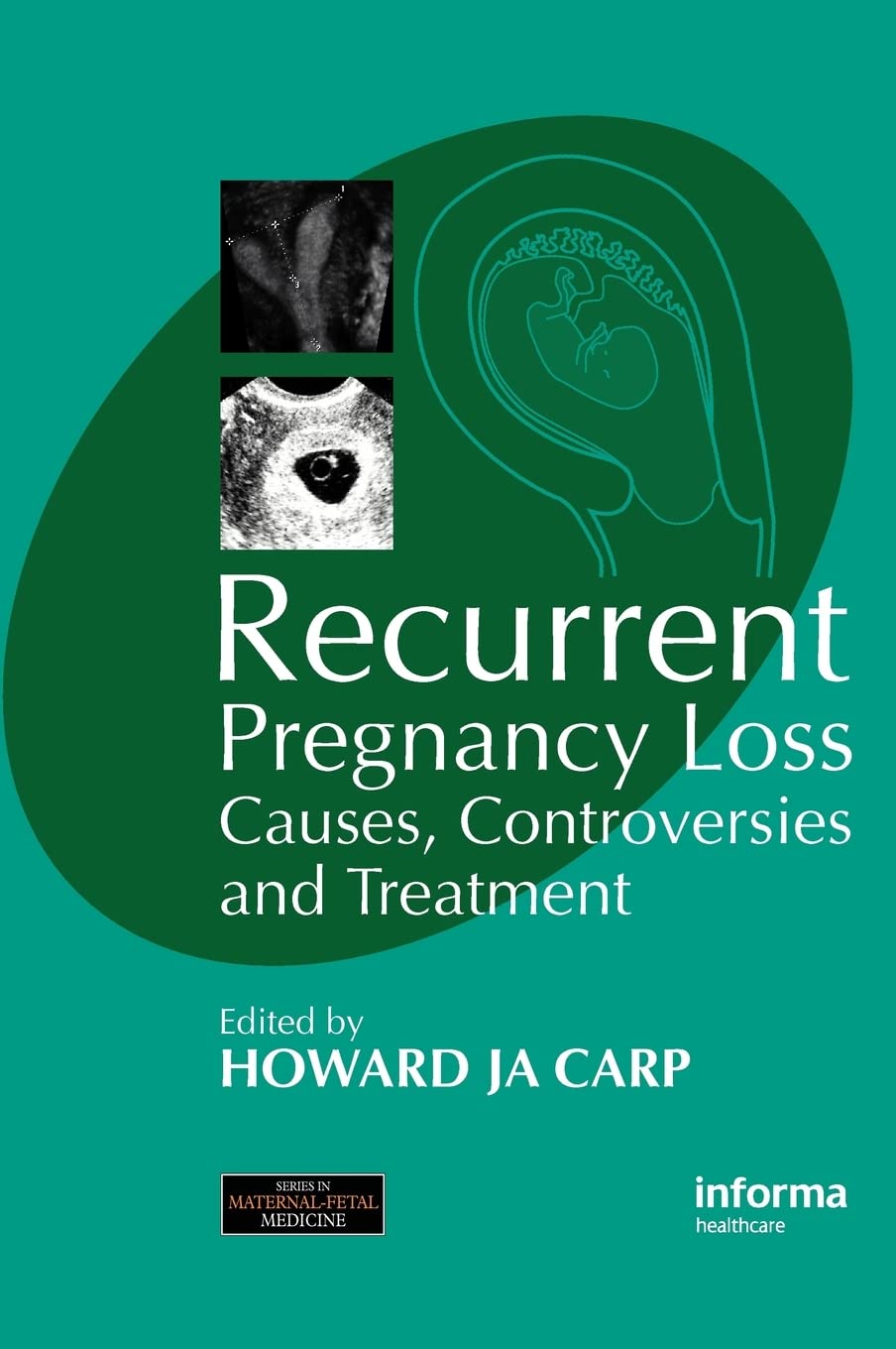 Recurrent Pregnancy Loss: Causes, Controversies & Treatment Options | Maternal Fetal Medicine Book | For Doctors, Researchers & Couples Trying to Conceive