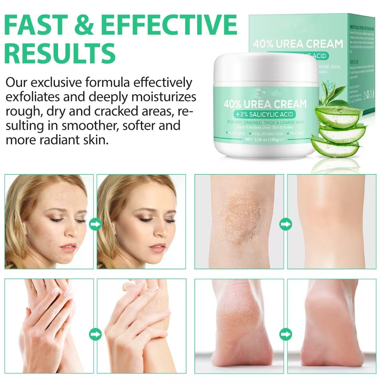 40% Urea Cream with 2% Salicylic Acid - Maximum Strength Foot & Hand Moisturizer for Dry, Cracked Heels, Elbows & Knees | Deep Hydration & Skin Repair | Ideal for Cracked Feet, Rough Skin & Callus Removal