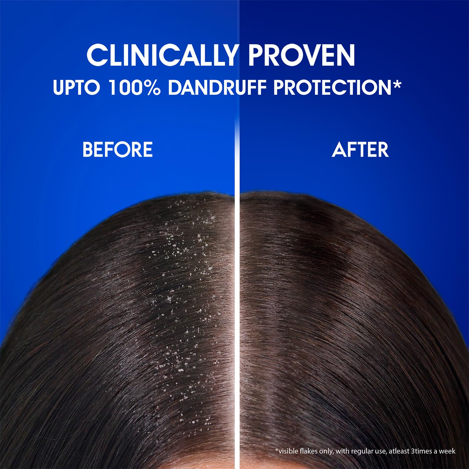 Head & Shoulders Anti Dandruff Shampoo for Smooth & Silky Hair - 180ml (6oz) White Bottle | Gentle Daily Cleansing for Flaky Scalp & Itch Relief | Perfect for Men & Women at Home or Travel