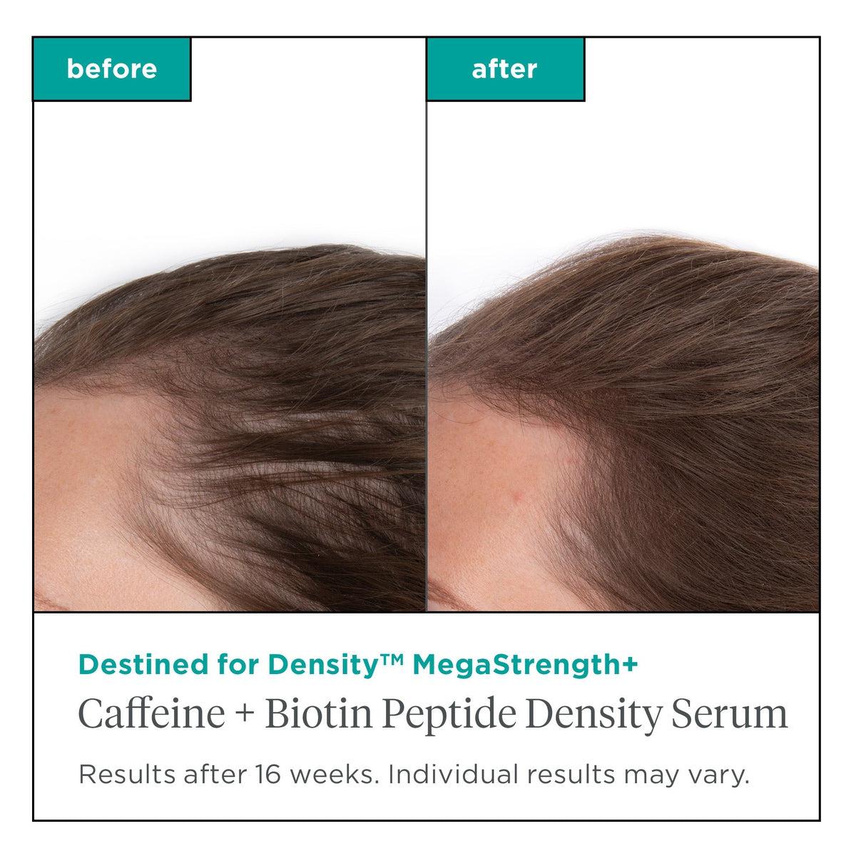 Destined For Density Megastrength+ Caffeine & Biotin Peptide Hair Growth Serum - Thickening Treatment for Thinning Hair | Promotes Fuller, Healthier Locks | Daily Use for Men & Women