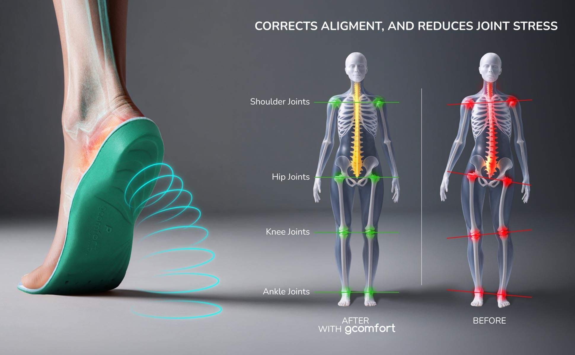 Gravity Defyer G-Comfort Orthotic Insoles for Women - Arch Support for Pronation & Flat Feet Relief - 6 Medium US - Perfect for Running, Walking & All-Day Comfort