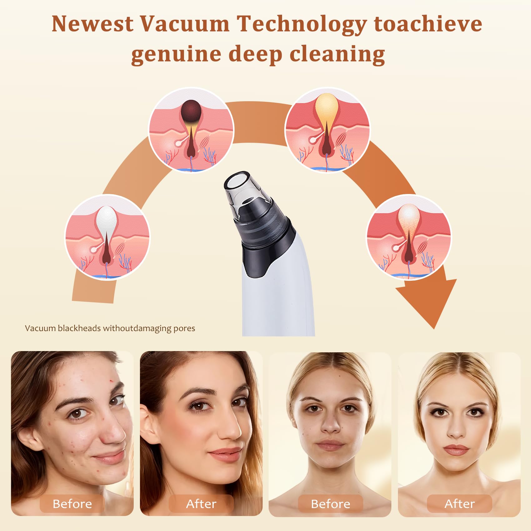 Blackhead Remover Vacuum - Powerful Pore Cleaner with 3 Adjustable Suction Levels & 4 Extraction Tools | USB Rechargeable Facial Cleansing Device for Women & Men | Perfect for Daily Skincare Routine & Deep Pore Cleansing at Home