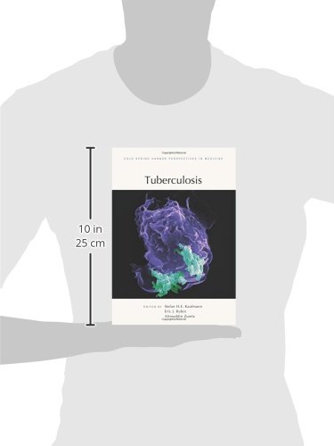 Tuberculosis: Comprehensive Guide from Cold Spring Harbor Perspectives in Medicine - Essential Resource for Medical Professionals & Researchers