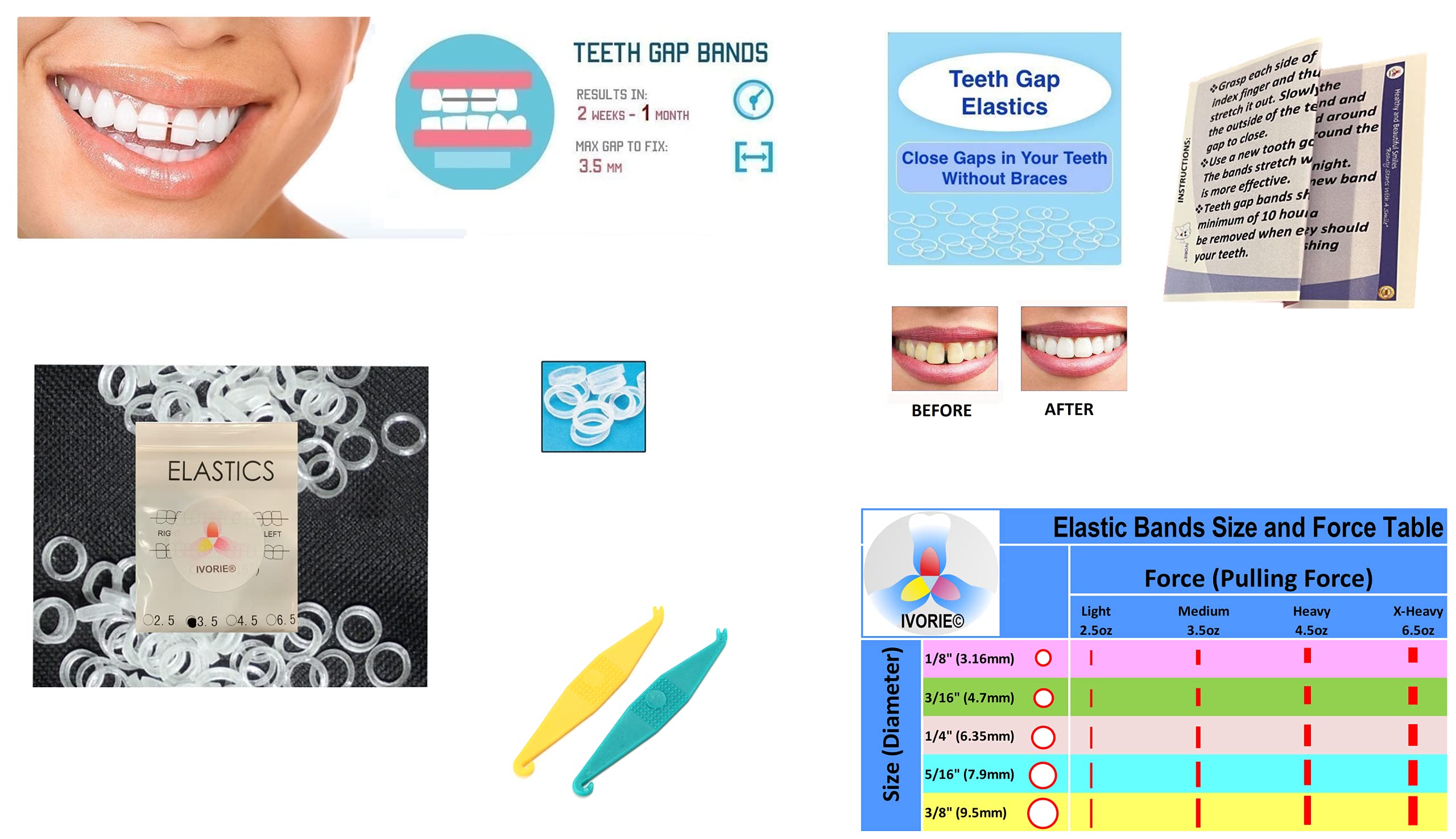 IVORIE Dental Orthodontic Rubber Bands - 100pcs Braces Elastics for Teeth Gap (5/16