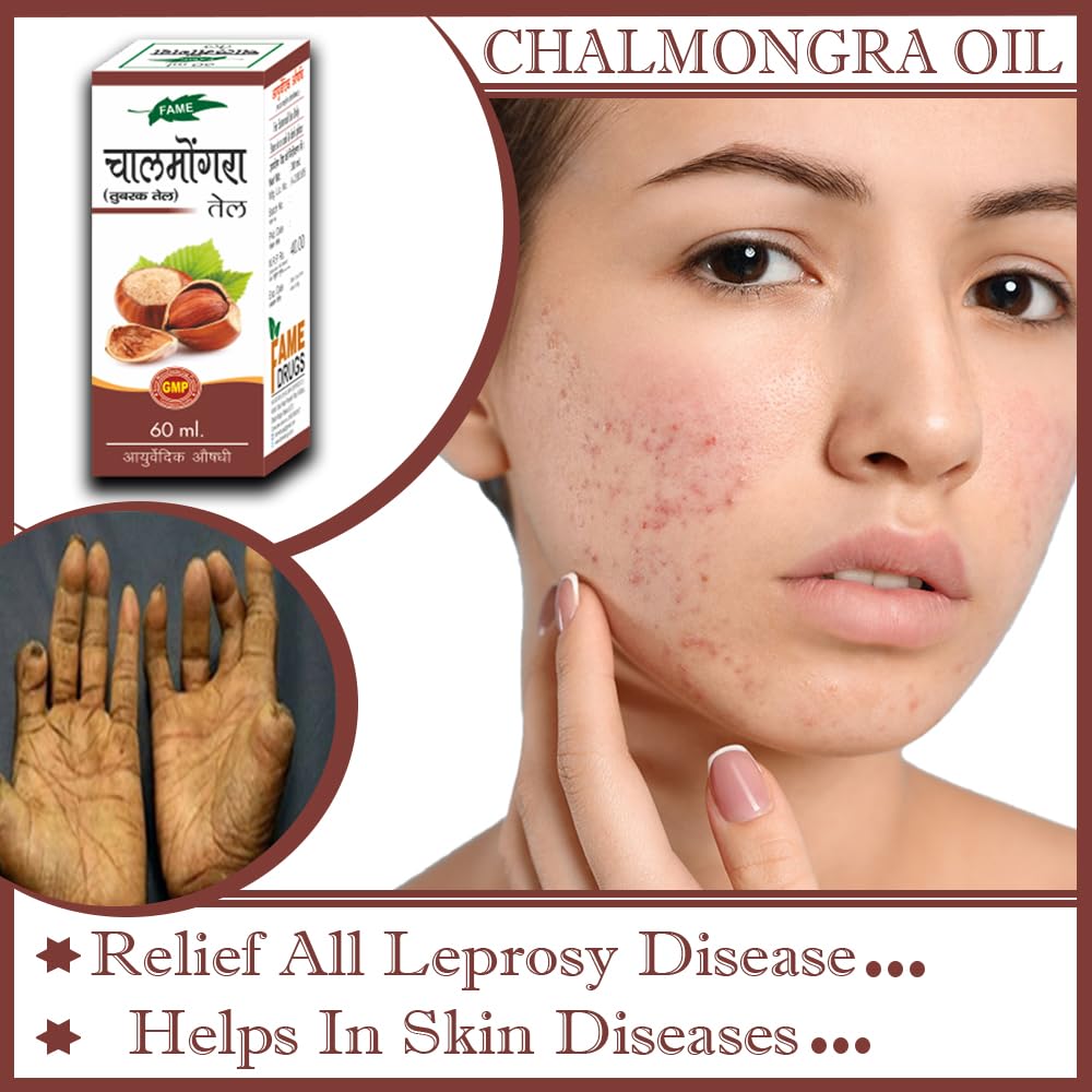 Pure Ayurvedic Chalmogra Oil for Skin Care - 60ml | Natural Treatment for Eczema, Psoriasis & Skin Conditions | Perfect for Daily Moisturizing & Massage Therapy