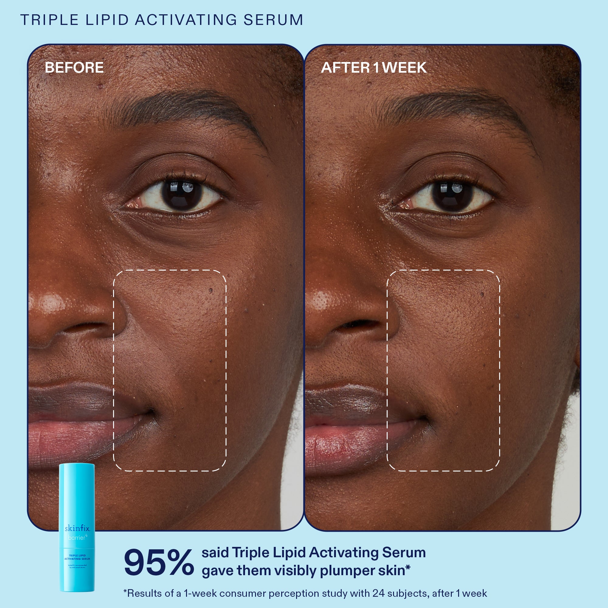 Barrier+ Plump + Refine Lip Gloss - Hydrating & Volumizing Lip Plumper with Natural Oils for Fuller Lips | Perfect for Daily Wear, Date Night & Special Occasions