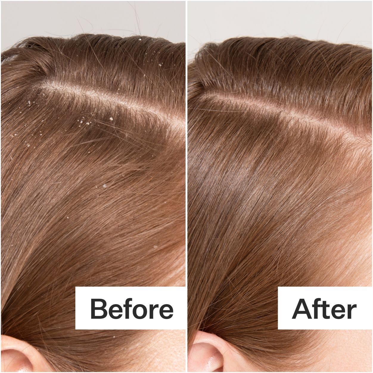 Organic Cold Processed Scalp Detox Shampoo for Dandruff & Itchy Scalp Relief - Natural Hair Care for Dry, Flaky Scalp - Perfect for Daily Use & Sensitive Scalp Treatment