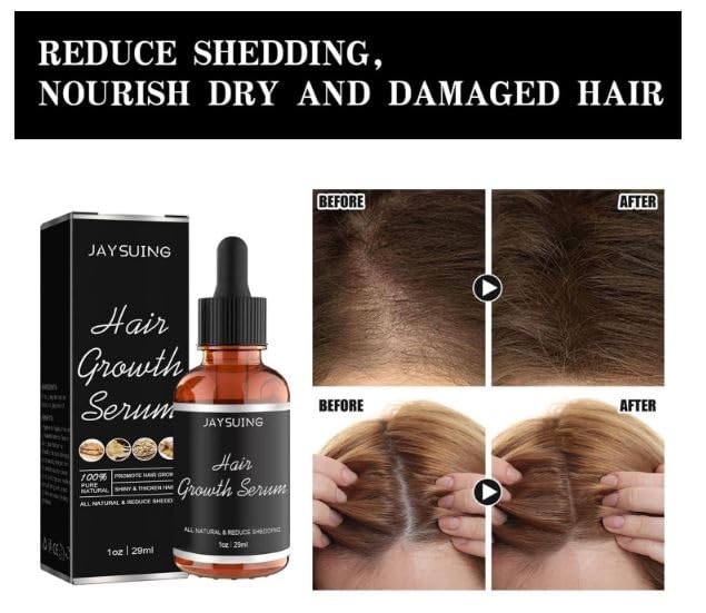 Kudh Products Ultimate Hair Growth Serum - Anti Hair Loss Treatment for Women | Nourishes Dry & Damaged Hair | Promotes Thick, Strong & Healthy Hair Growth | 29ml | Perfect for Daily Hair Care Routine & Scalp Treatment
