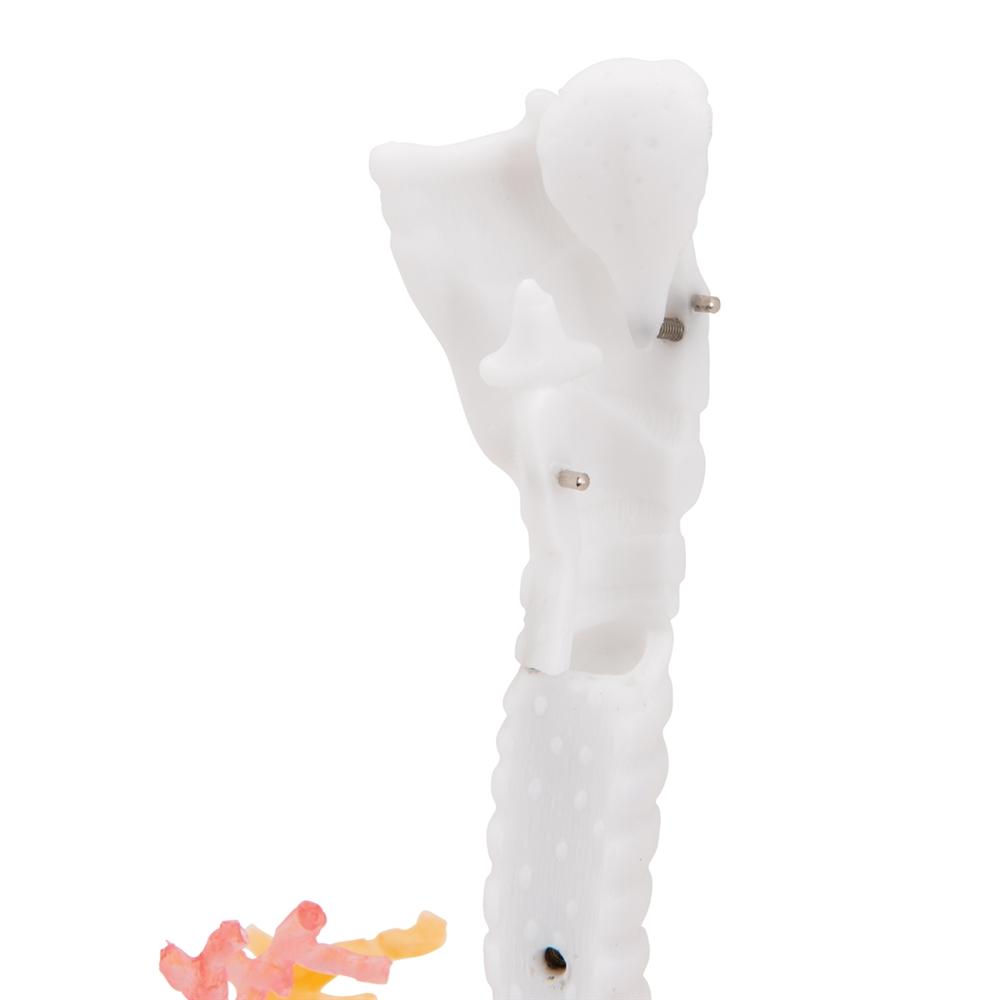 CT Bronchial Tree with Larynx Model - Human Respiratory System Anatomy Model for Medical Students, Doctors & Educators | Perfect for Classroom Demonstrations & Patient Education