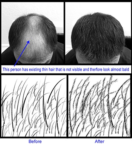 Best Hair Loss Concealer & Thickening Fibers - 1KG Black | USA Made for All Hair Types | Perfect for Thinning Hair, Bald Spots & Daily Styling
