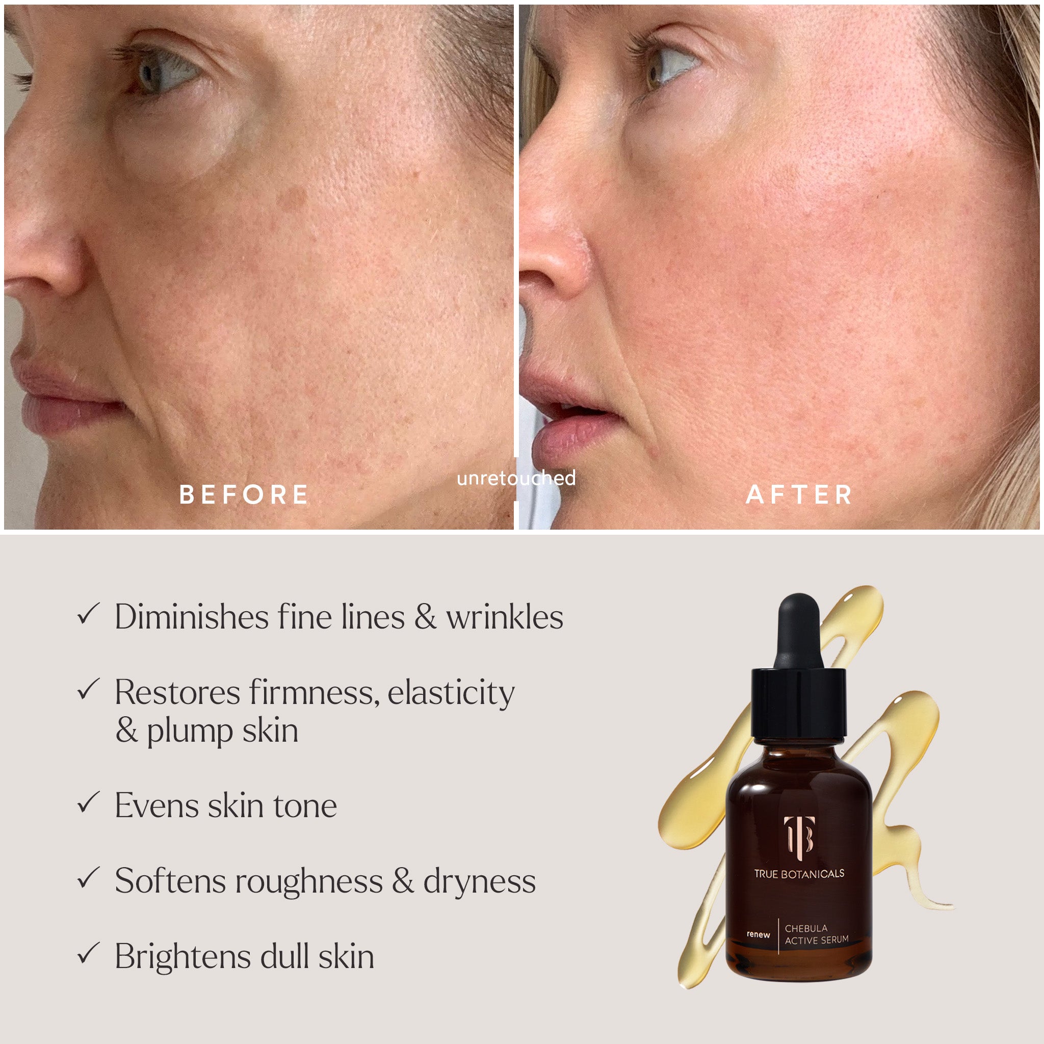 Deep Hydration Renewal 3-Piece Skincare Set - Daily Moisturizing Essentials for Dry Skin | Morning & Night Routine
